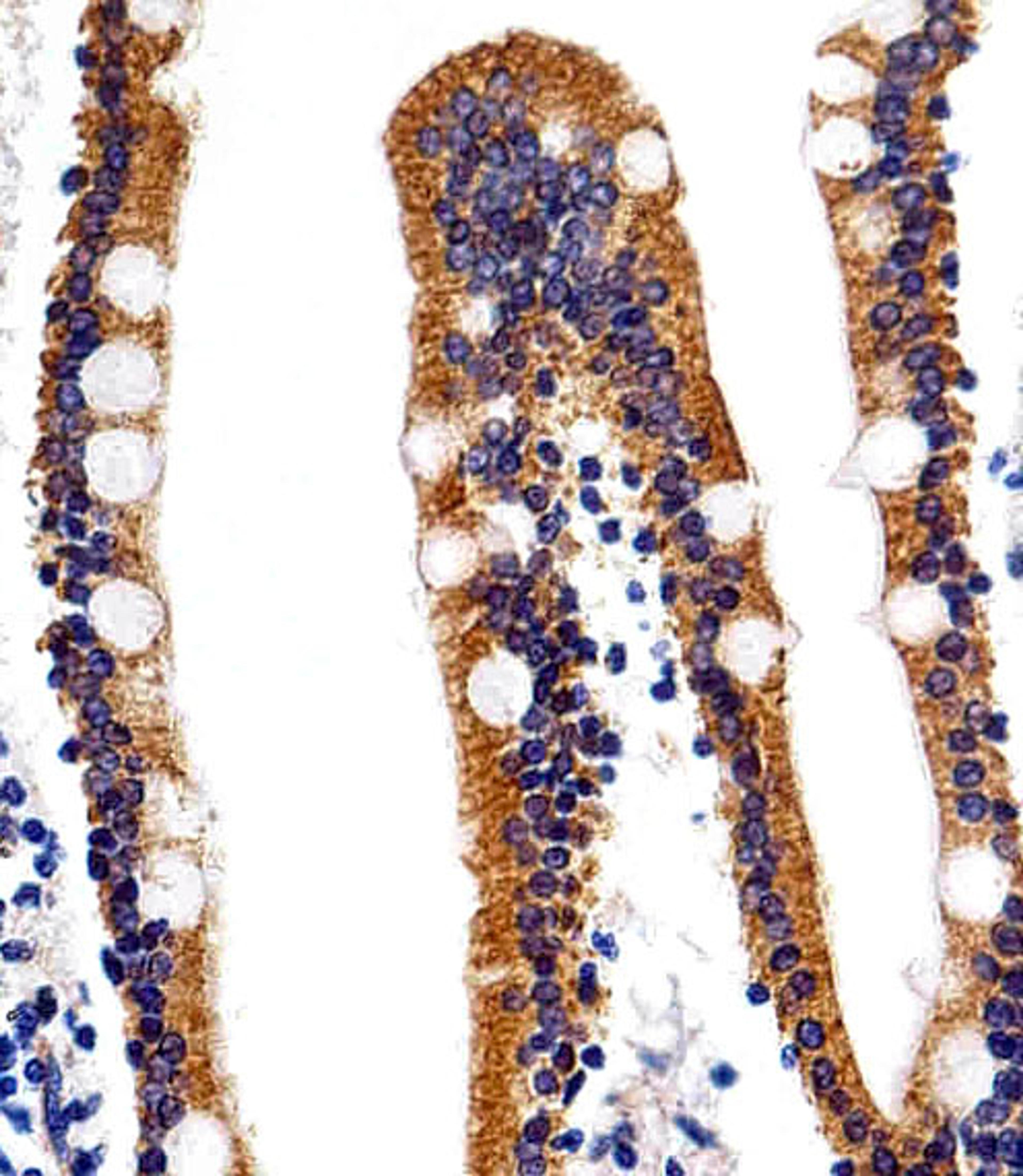 Immunohistochemical analysis of paraffin-embedded H.small intestine section using ACVRL1 Antibody (N-term). Antibody was diluted at 1:25 dilution. A peroxidase-conjugated goat anti-rabbit IgG at 1:400 dilution was used as the secondary antibody, followed 