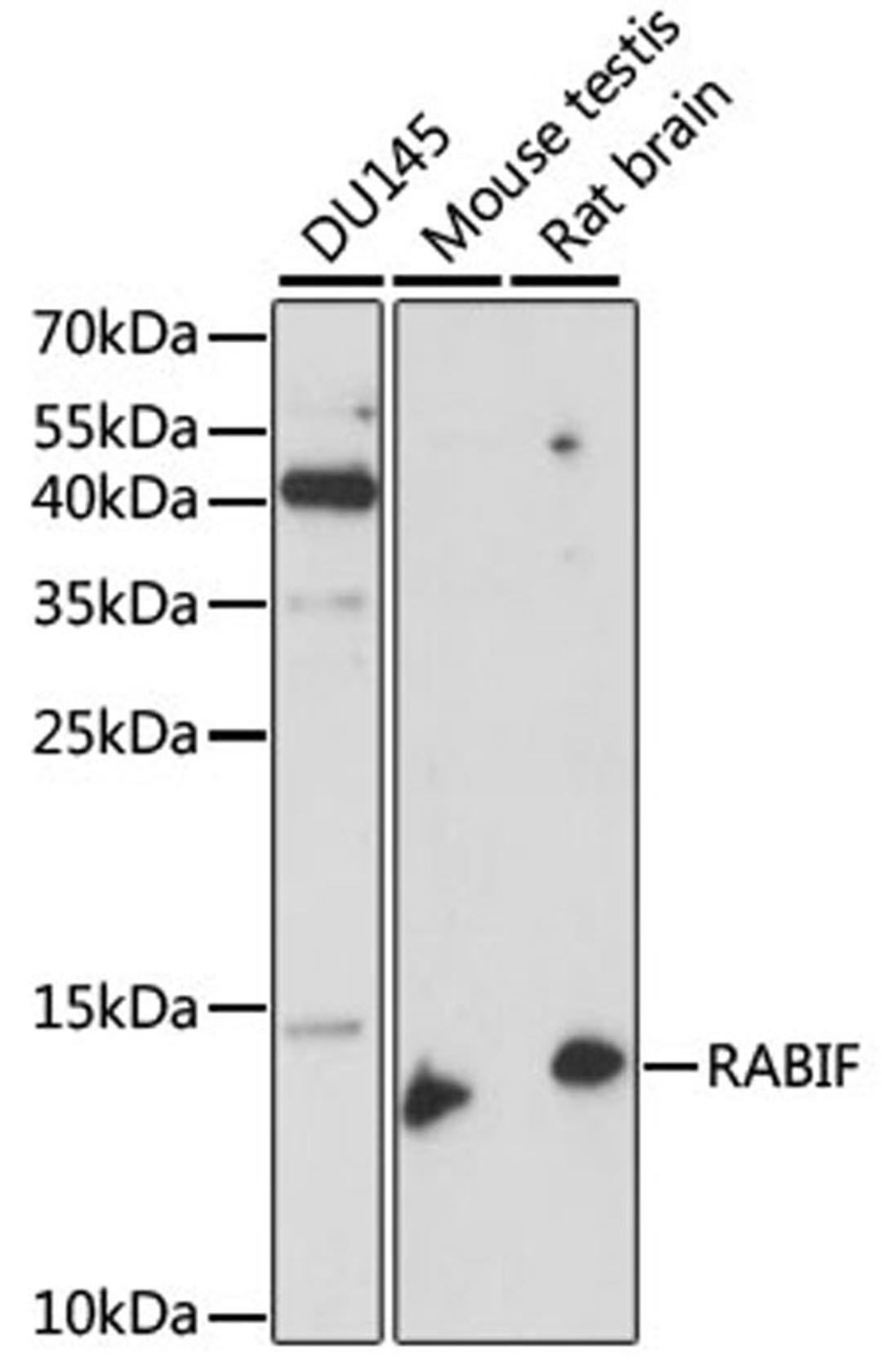 Western blot - RABIF antibody (A15090)