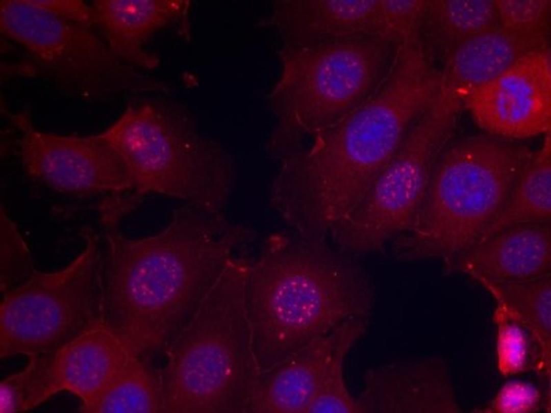 Immunocytochemistry/Immunofluorescence: Estrogen Receptor alpha [p Ser167] Antibody [NB100-81914] - Staining of methanol-fixed MCF cells using Estrogen Receptor alpha (Phospho-Ser167) Antibody.