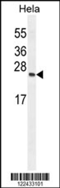 Western blot analysis in Hela cell line lysates (35ug/lane).