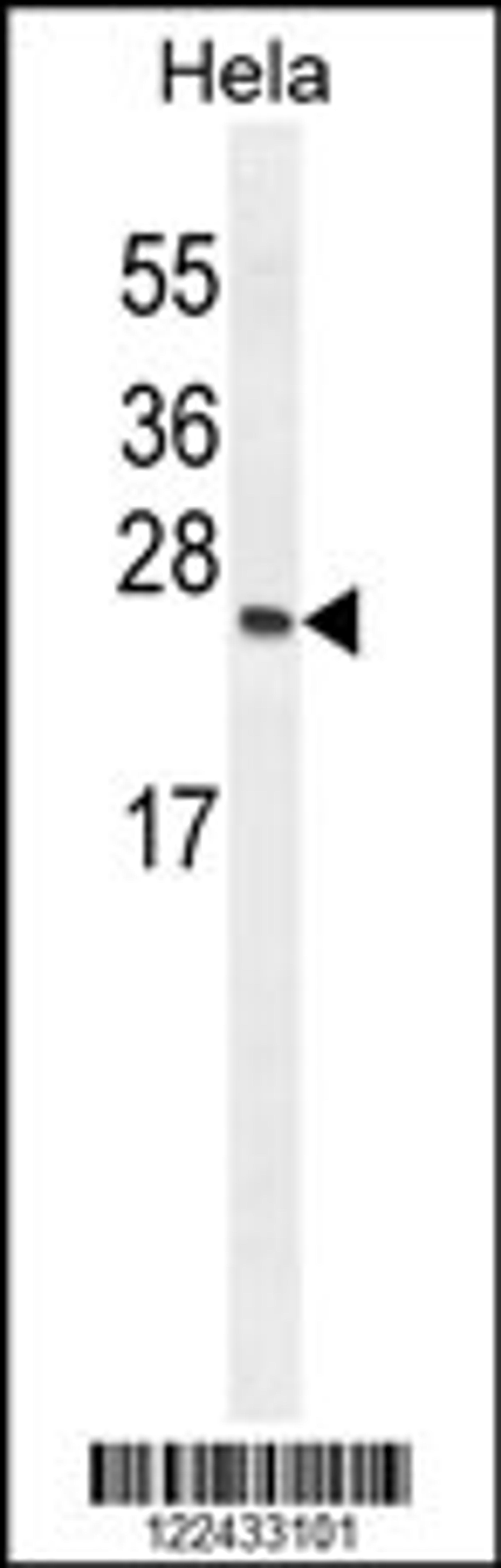 Western blot analysis in Hela cell line lysates (35ug/lane).