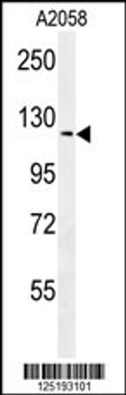 Western blot analysis in A2058 cell line lysates (35ug/lane).