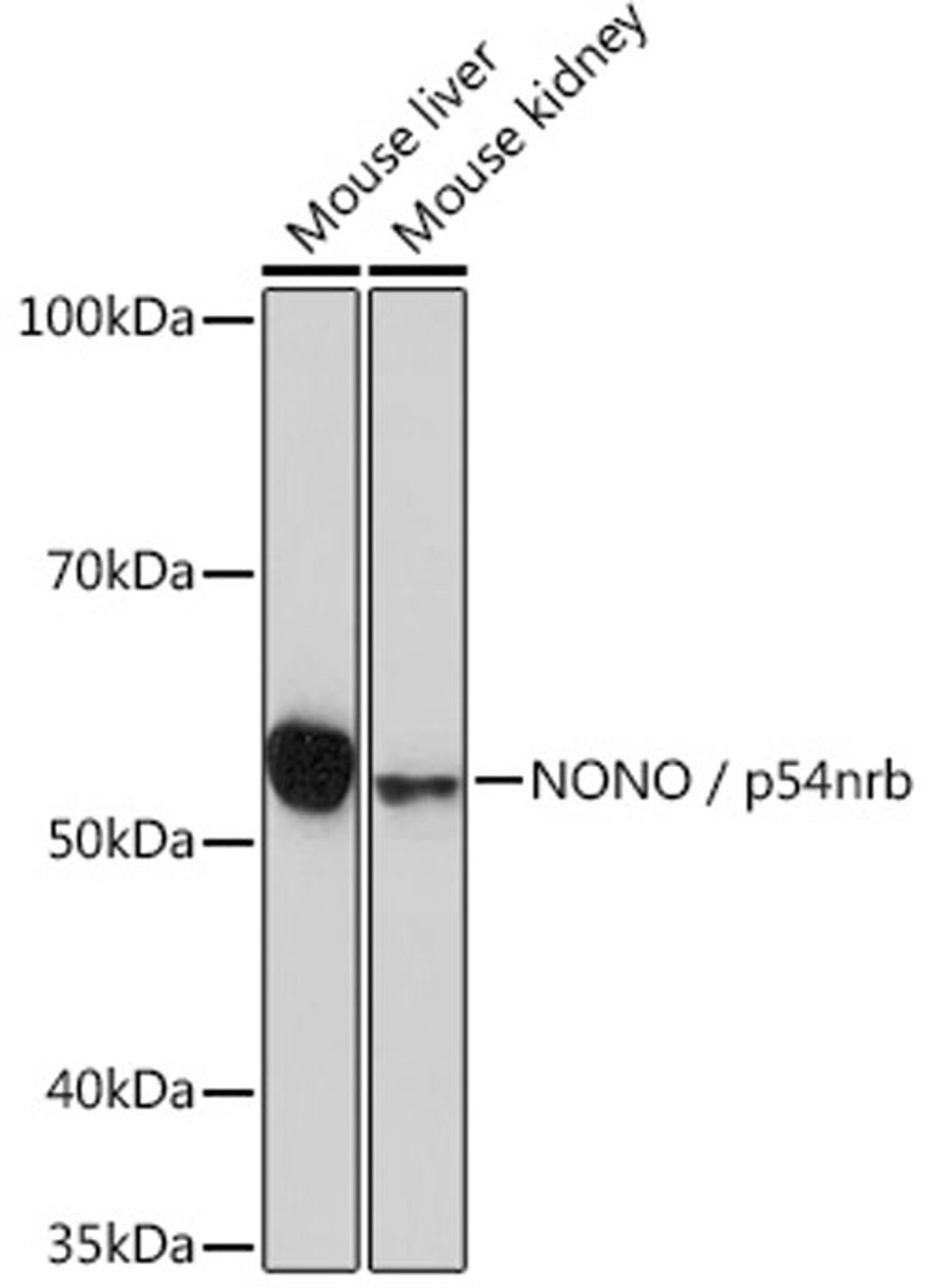 Western blot - NONO / p54nrb Rabbit mAb (A3800)