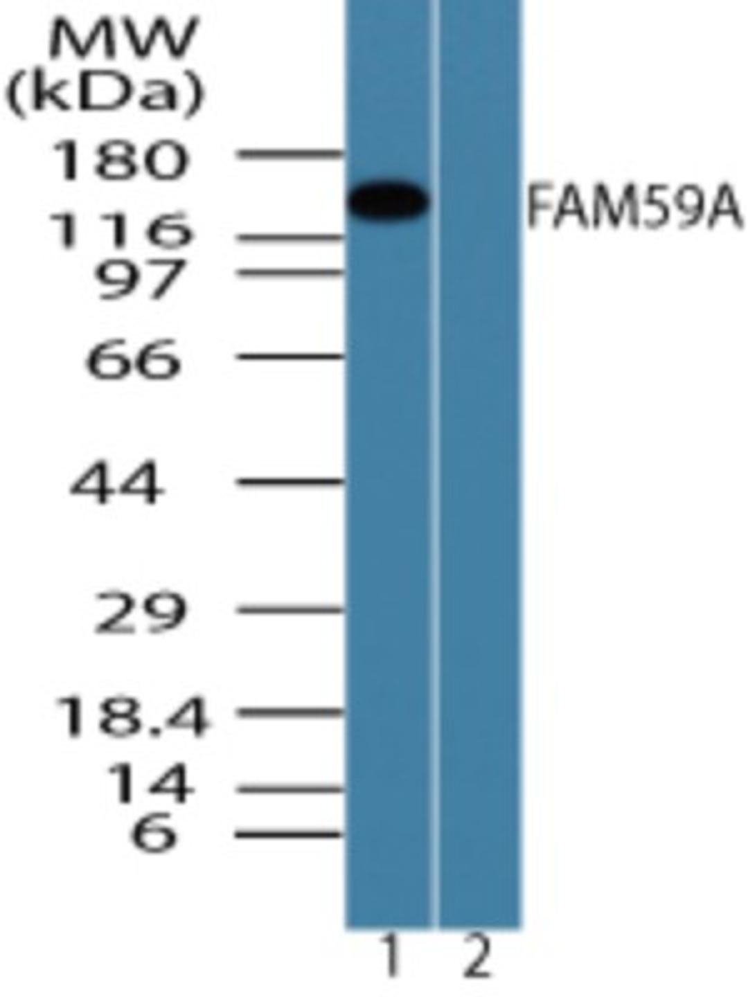 Western Blot: C18orf11 Antibody [NBP2-24573] - analysis of FAM59A in HCT-116 cell lysate in the 1) absence and 2) presence of immunizing peptide using the FAM59A antibody at 0.5 ug/ml.