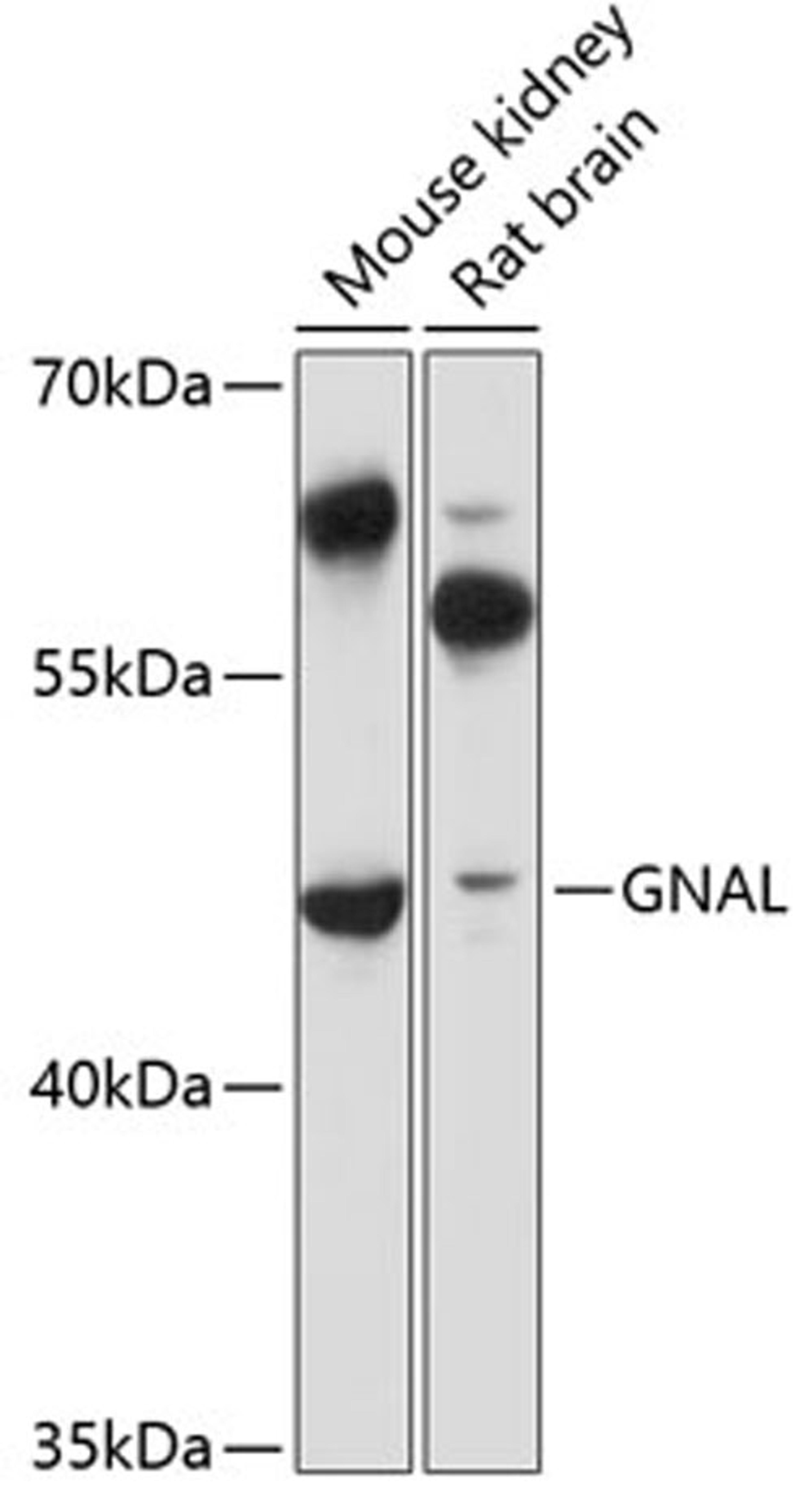 Western blot - GNAL antibody (A12868)