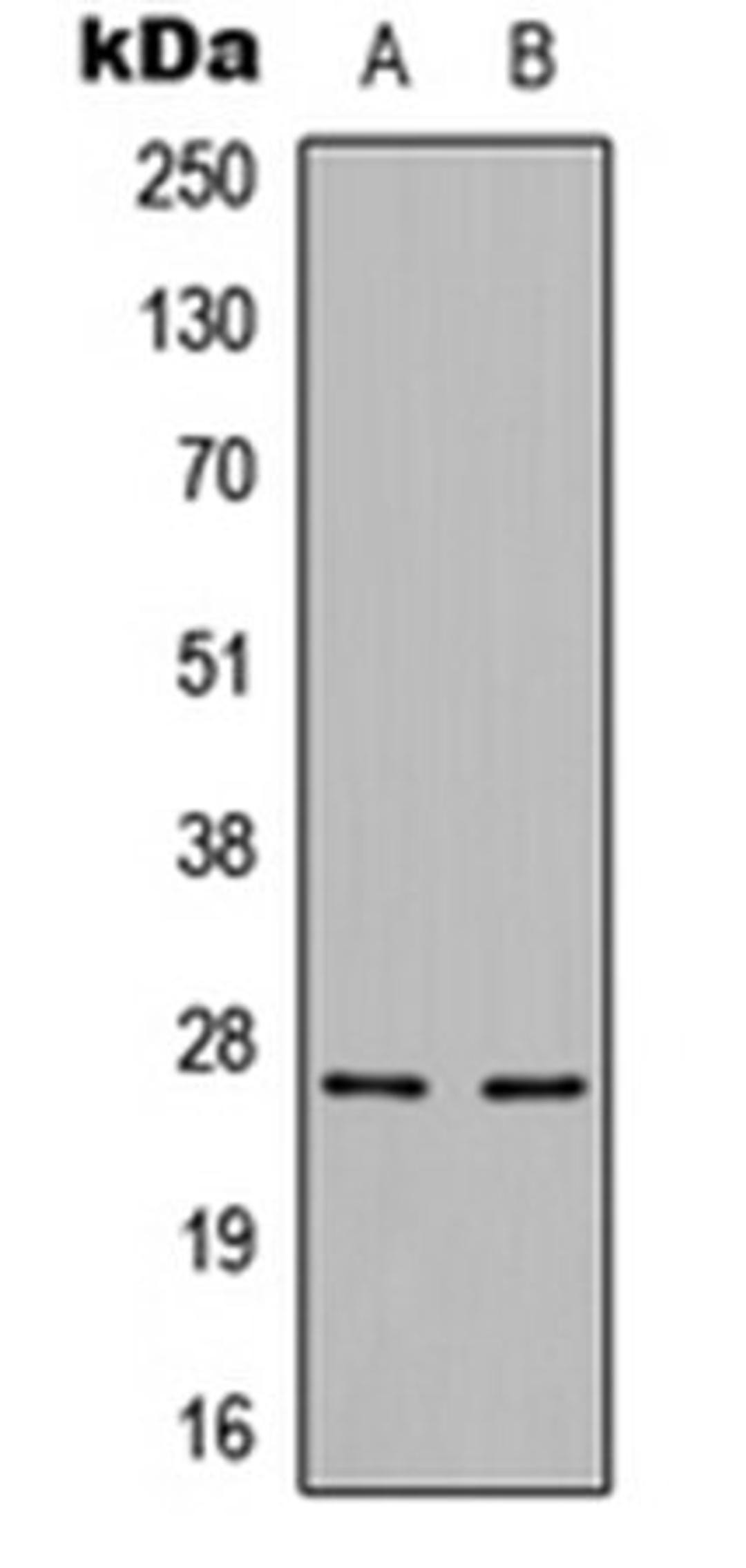 Western blot analysis of HepG2 (Lane 1), mouse brain (Lane 2) whole cell lysates using Cerebellin 3 antibody