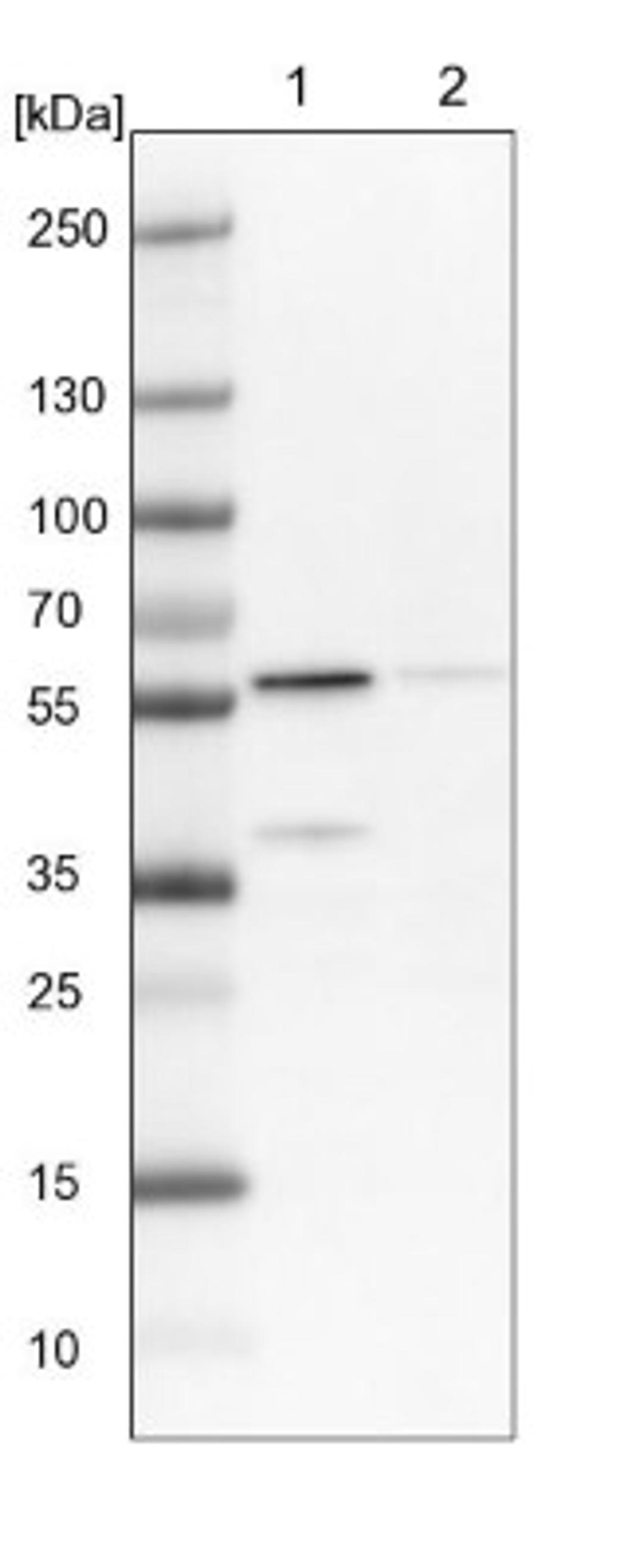 Western Blot: OXCT1 Antibody [NBP1-82462] - Lane 1: NIH-3T3 cell lysate (Mouse embryonic fibroblast cells)<br/>Lane 2: NBT-II cell lysate (Rat Wistar bladder tumour cells)