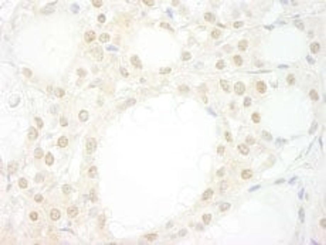 Detection of human WDR20 by immunohistochemistry.