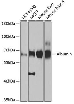 Western blot - Albumin antibody (A0353)