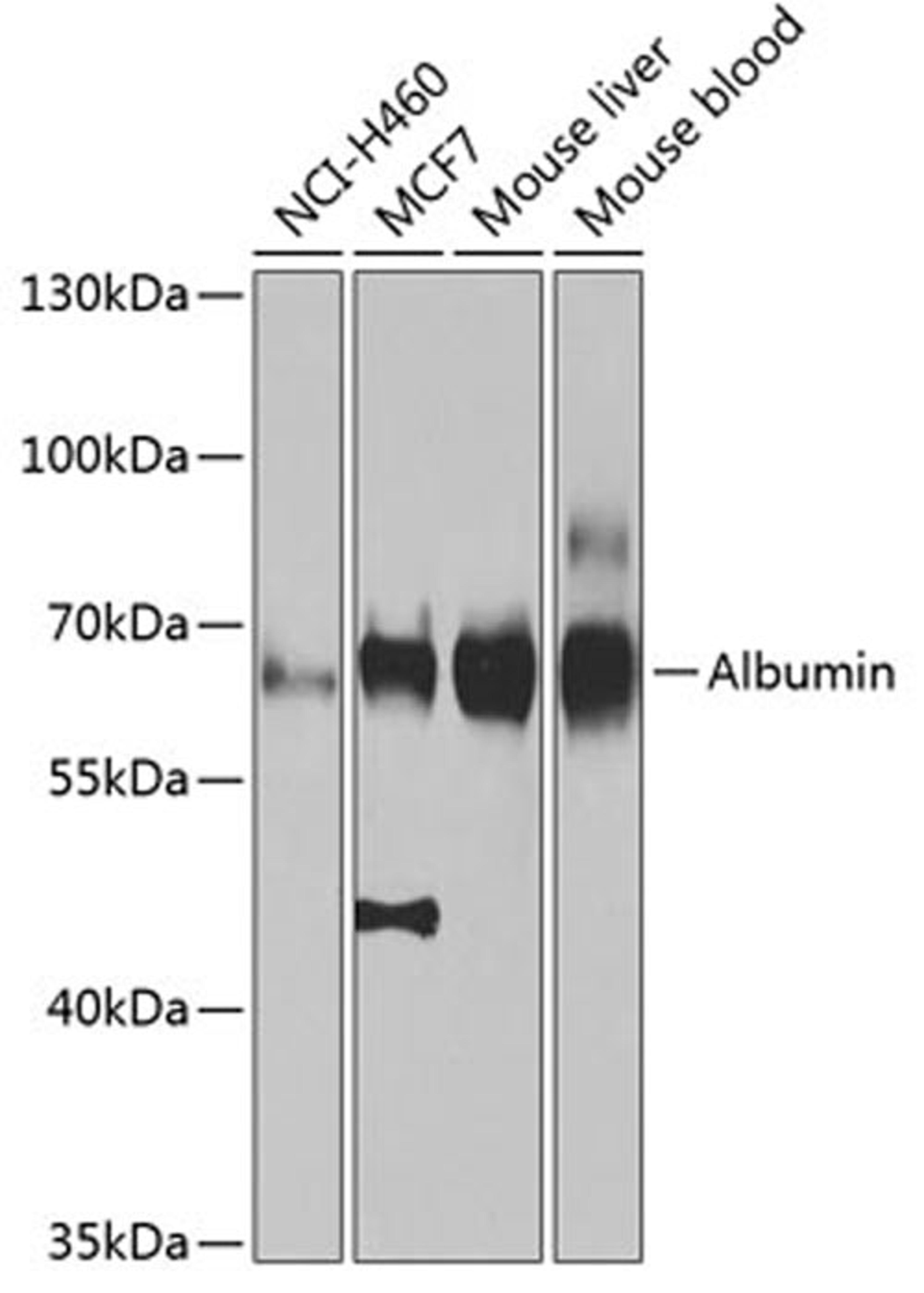 Western blot - Albumin antibody (A0353)