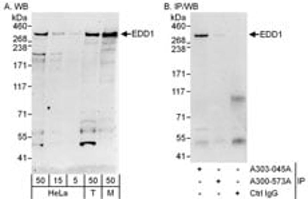 Detection of human and mouse EDD1 by western blot (h&m) and immunoprecipitation (h).