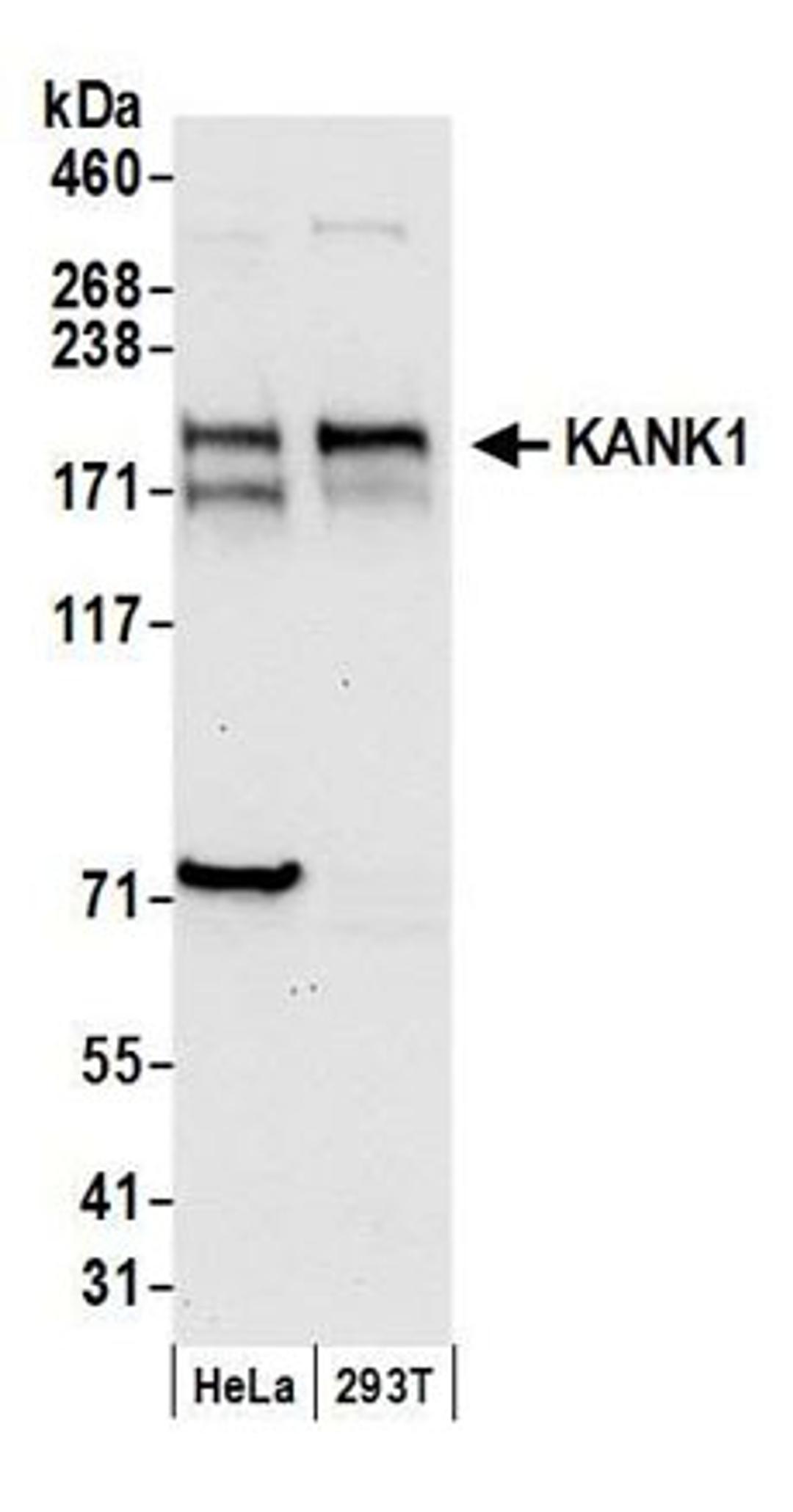 Detection of human KANK1 by western blot.