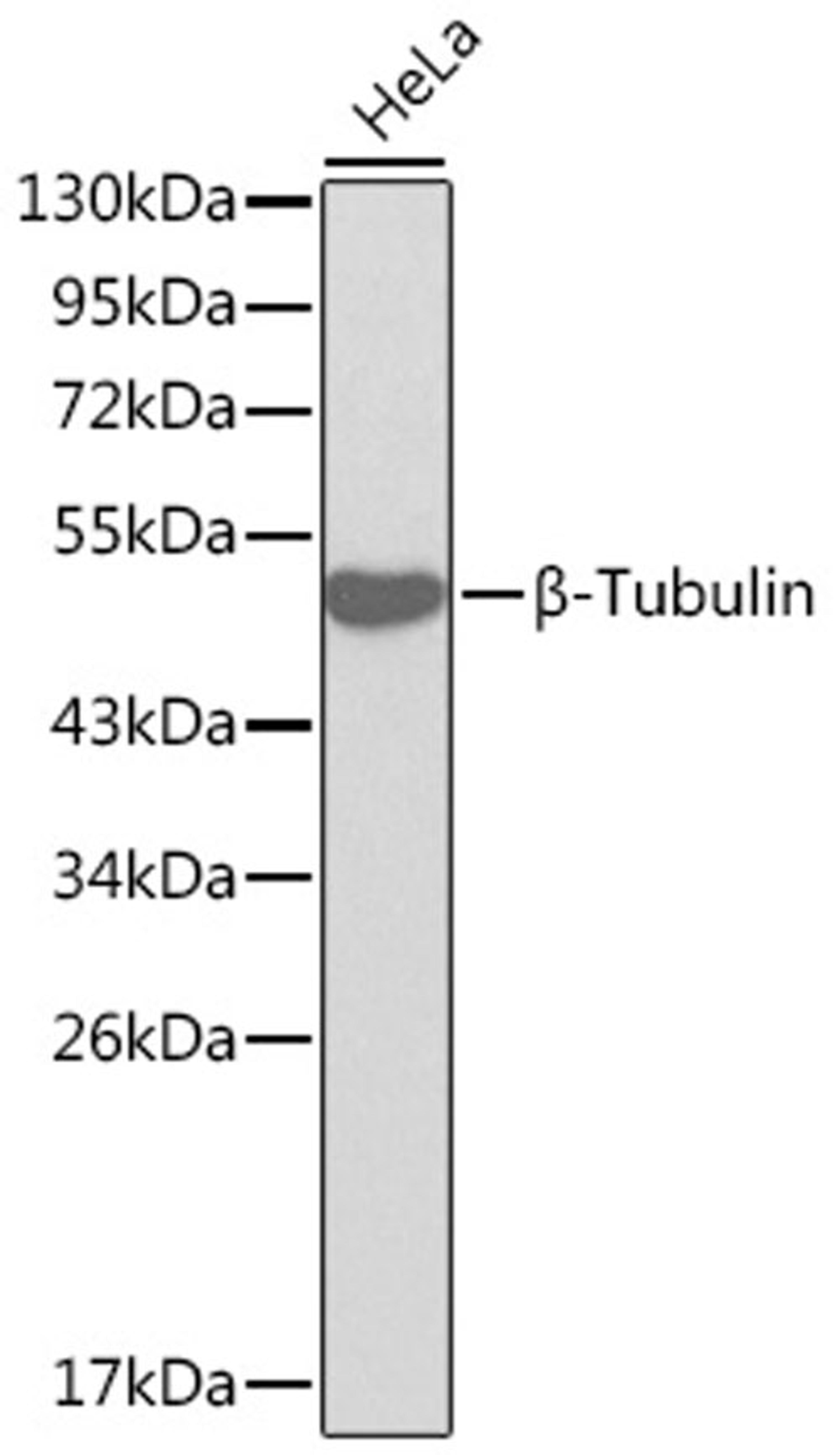 Western blot - ß-Tubulin antibody (A0482)