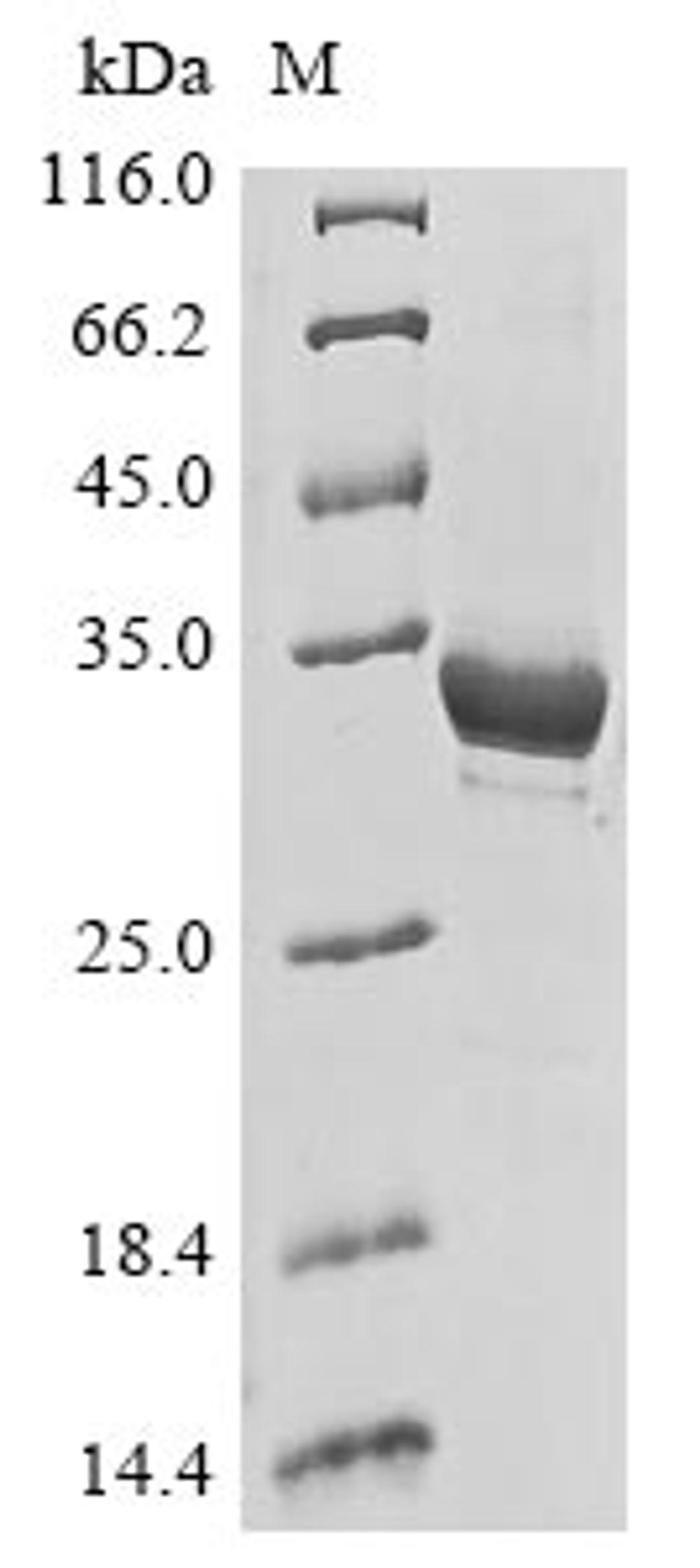 (Tris-Glycine gel) Discontinuous SDS-PAGE (reduced) with 5% enrichment gel and 15% separation gel.