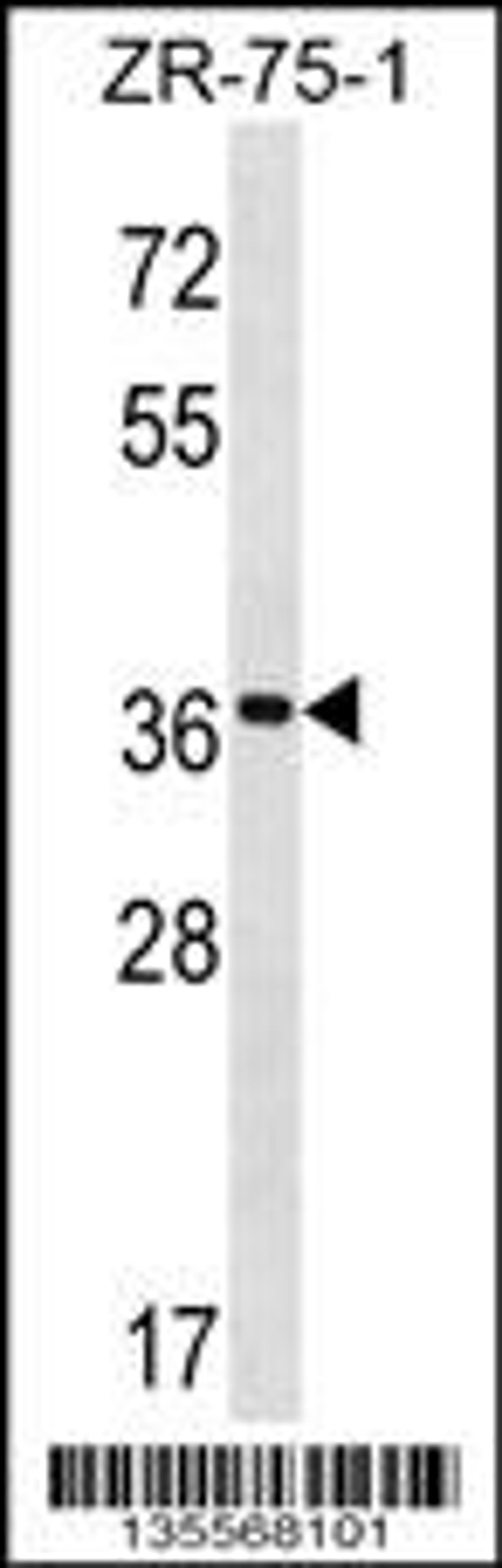 Western blot analysis in ZR-75-1 cell line lysates (35ug/lane).