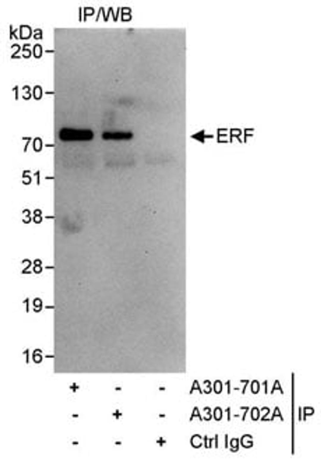 Detection of human ERF by western blot of immunoprecipitates.