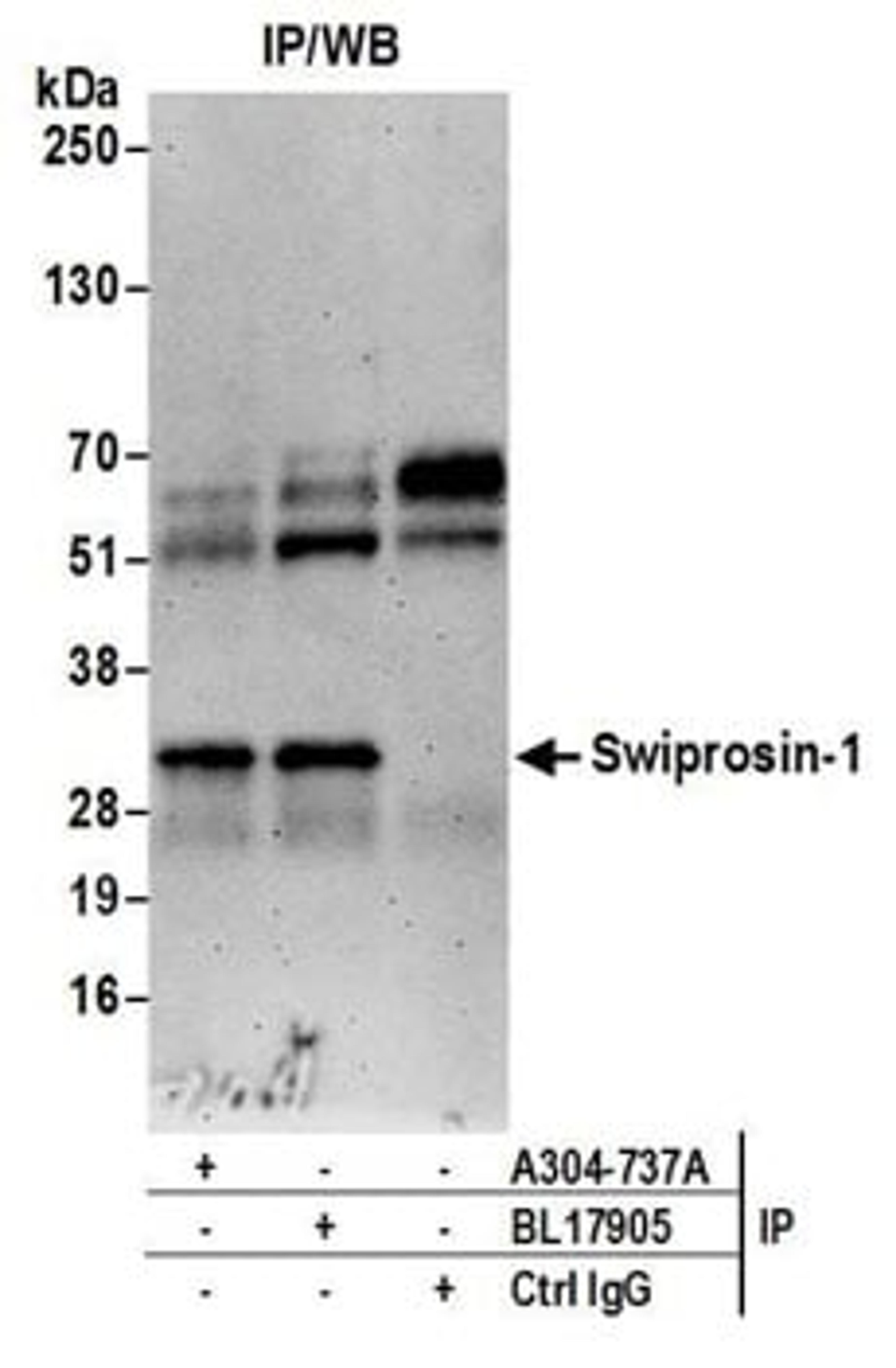 Detection of human Swiprosin-1 by western blot of immunoprecipitates.