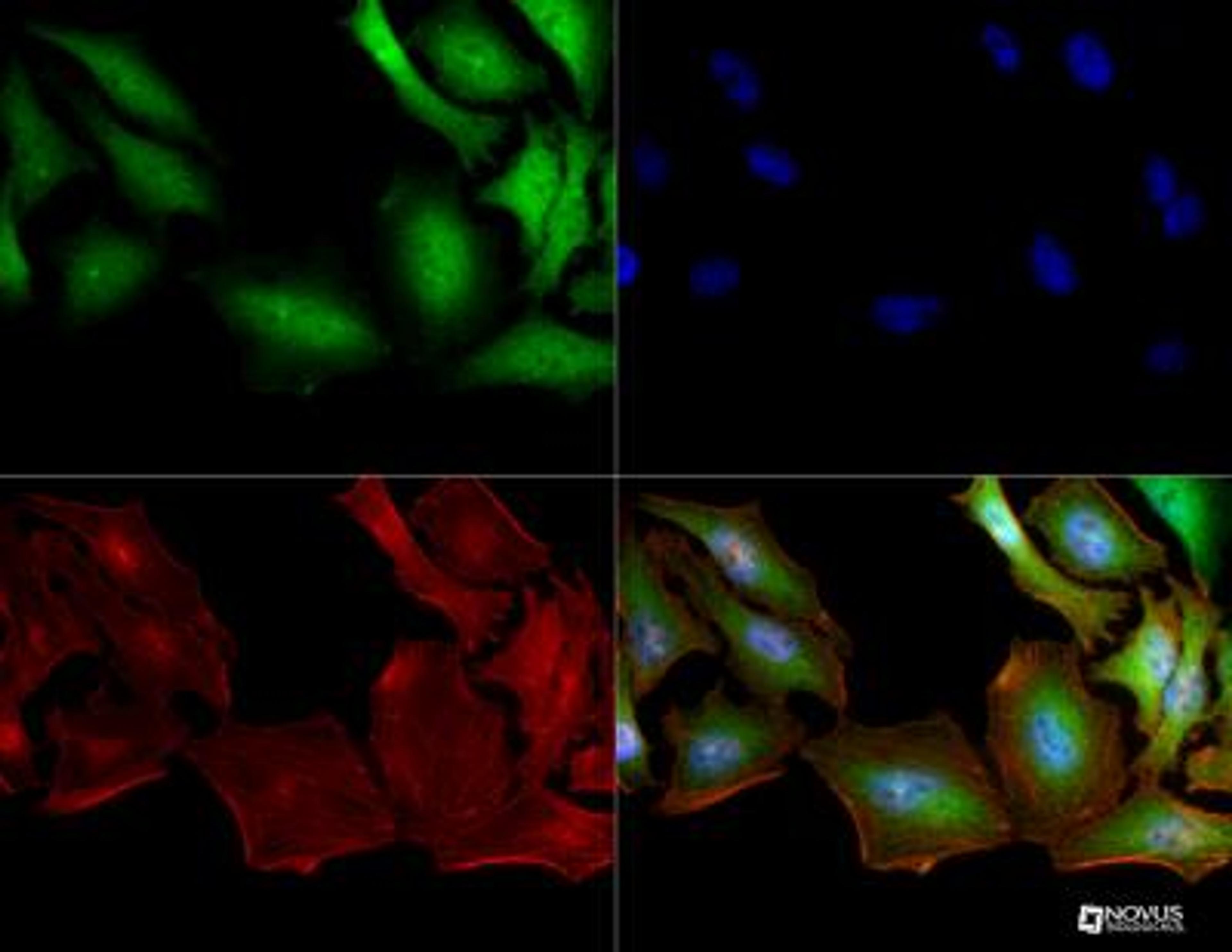 Immunocytochemistry/Immunofluorescence: S100A4 Antibody (1C4) [NBP2-36431] - S100A4 (1C4) antibody was tested in HeLa cells with Dylight 488 (green). Nuclei and alpha-tubulin were counterstained with DAPI (blue) and Dylight 550 (red).