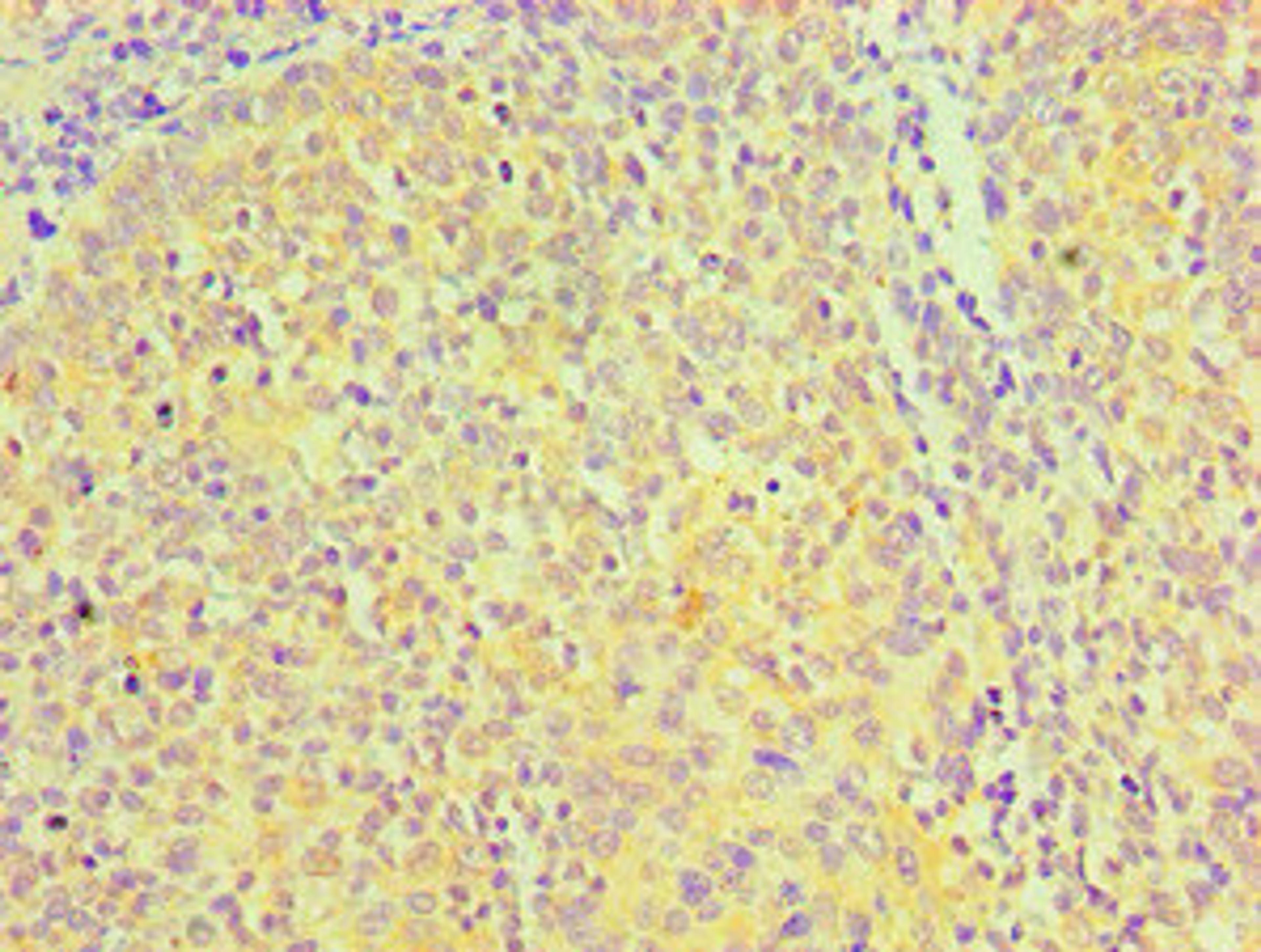 Immunohistochemical of paraffin-embedded Human tonsil tissue using CSB-MA0049601A0m at dilution of 1:200.