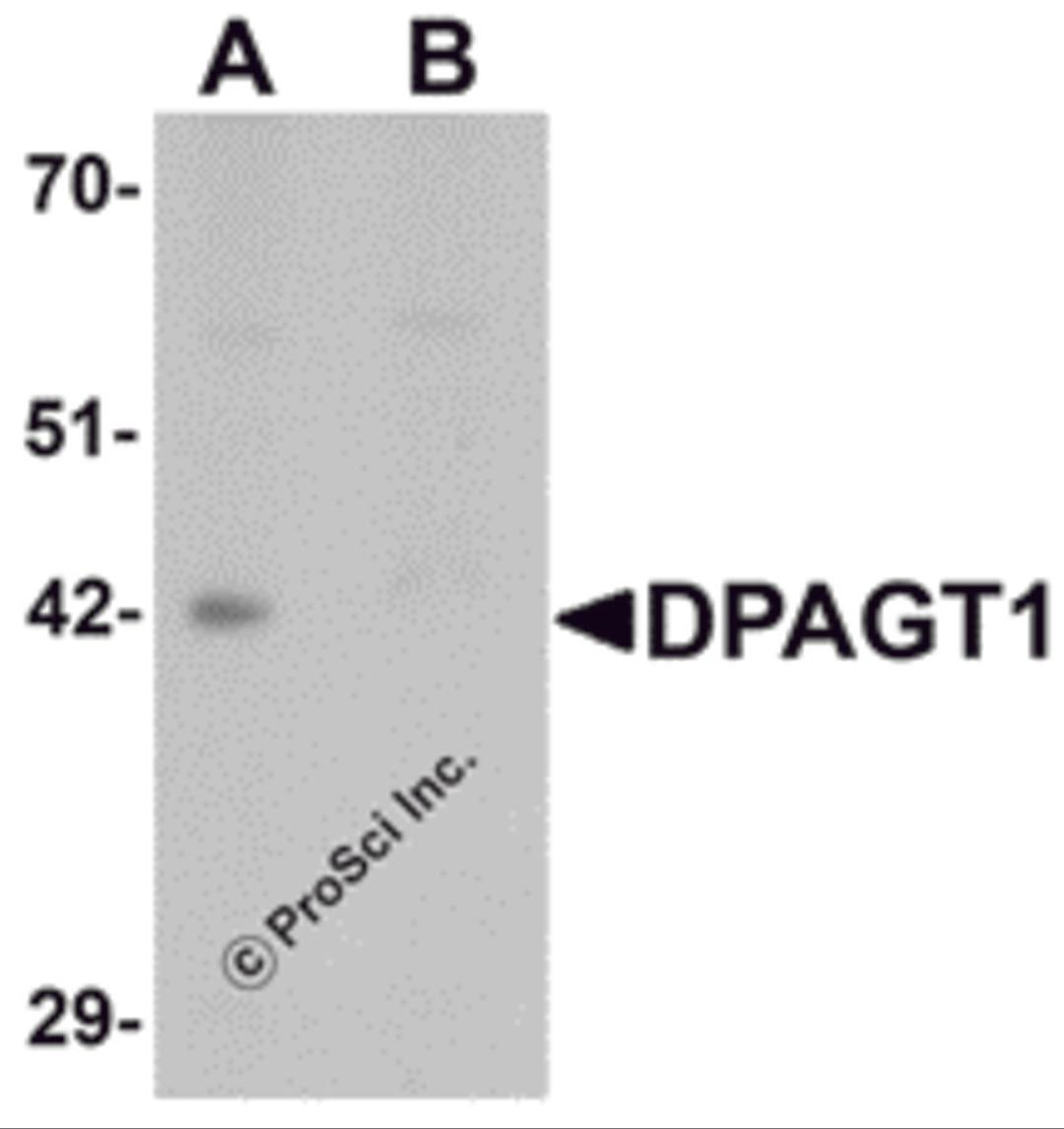 Western blot analysis of DPAGT1 in mouse kidney tissue lysate with DPAGT1 antibody at 1 &#956;g/mL in (A) the absence and (B) the presence of blocking peptide.