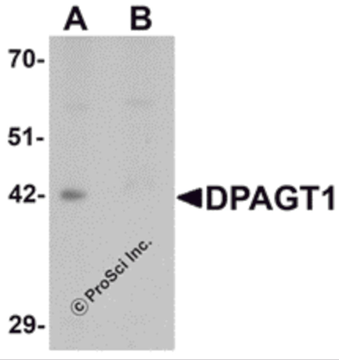 Western blot analysis of DPAGT1 in mouse kidney tissue lysate with DPAGT1 antibody at 1 μg/mL in (A) the absence and (B) the presence of blocking peptide.