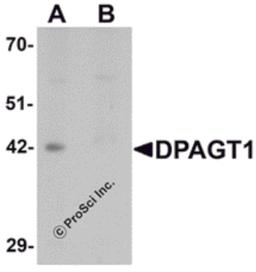 Western blot analysis of DPAGT1 in mouse kidney tissue lysate with DPAGT1 antibody at 1 μg/mL in (A) the absence and (B) the presence of blocking peptide.