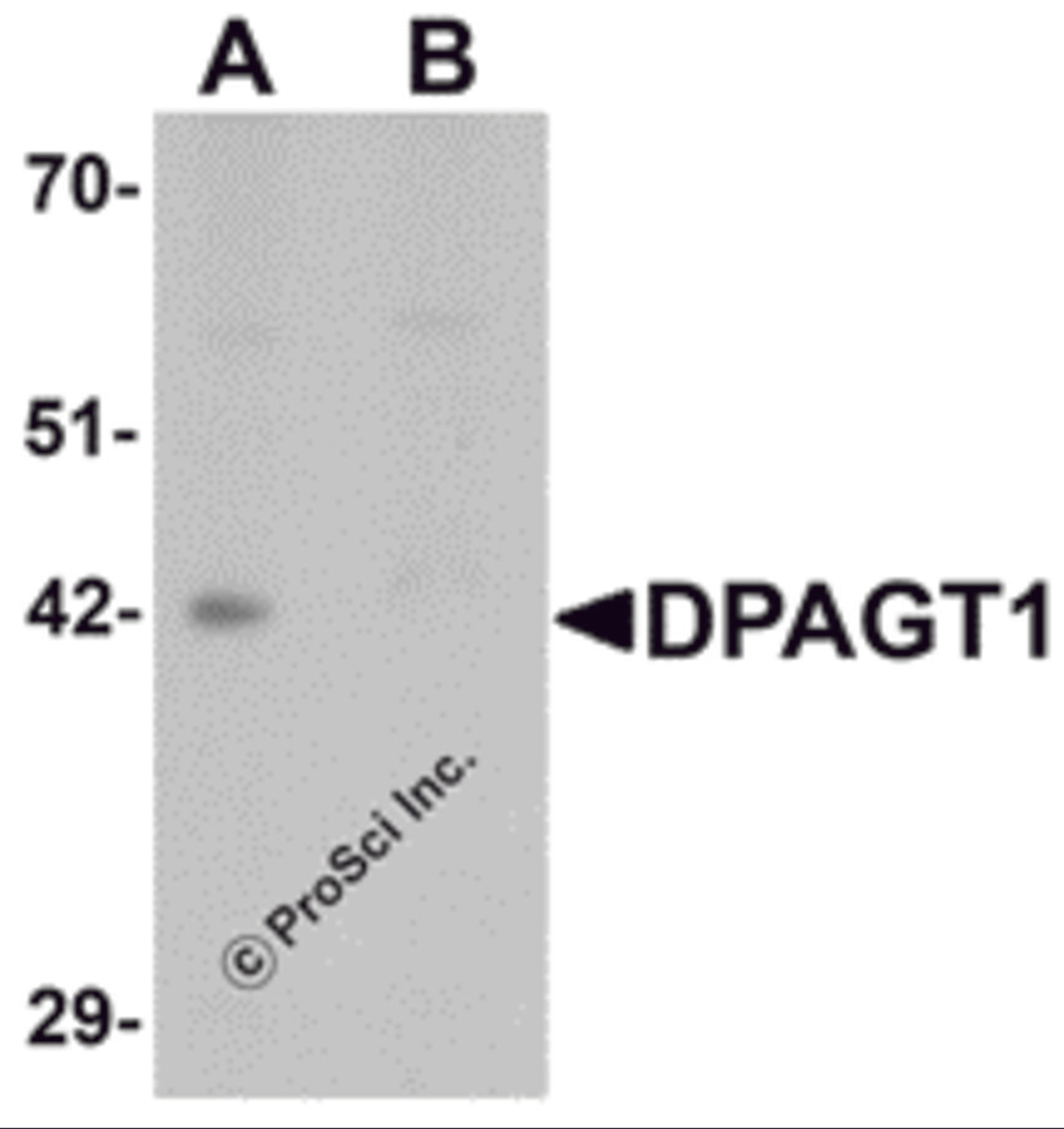 Western blot analysis of DPAGT1 in mouse kidney tissue lysate with DPAGT1 antibody at 1 μg/mL in (A) the absence and (B) the presence of blocking peptide.
