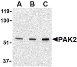 Western blot analysis of PAK2 in Jurkat lysate with PAK2 antibody at (A) 0.5, (B) 1 and (C) 2 &#956;g/mL.