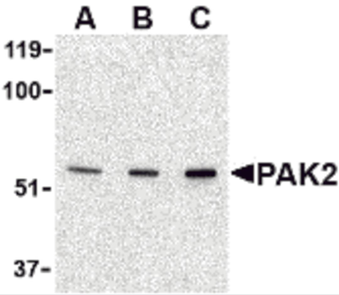 Western blot analysis of PAK2 in Jurkat lysate with PAK2 antibody at (A) 0.5, (B) 1 and (C) 2 μg/mL.