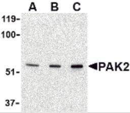 Western blot analysis of PAK2 in Jurkat lysate with PAK2 antibody at (A) 0.5, (B) 1 and (C) 2 μg/mL.