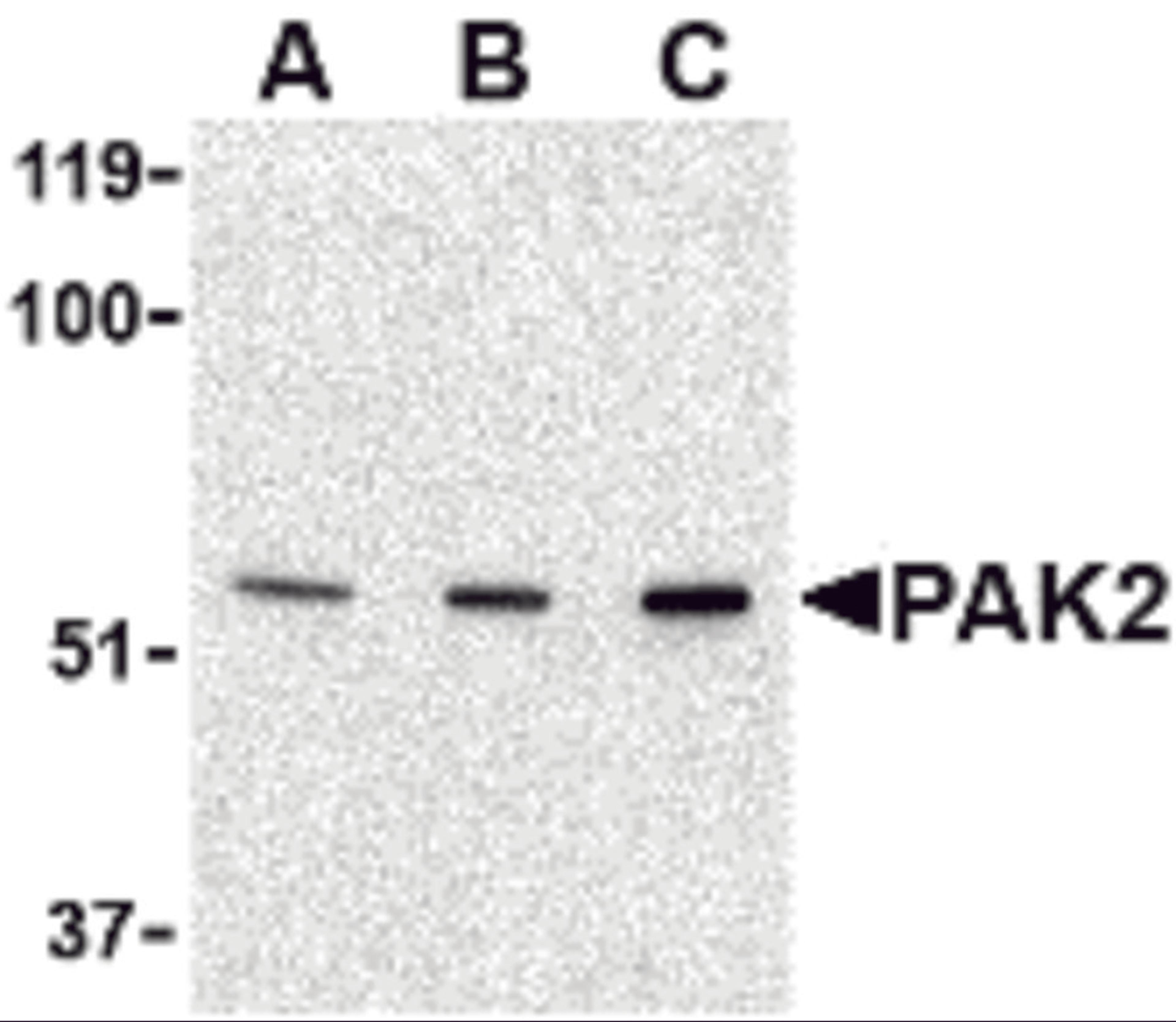 Western blot analysis of PAK2 in Jurkat lysate with PAK2 antibody at (A) 0.5, (B) 1 and (C) 2 μg/mL.