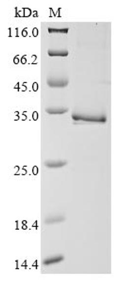 (Tris-Glycine gel) Discontinuous SDS-PAGE (reduced) with 5% enrichment gel and 15% separation gel.