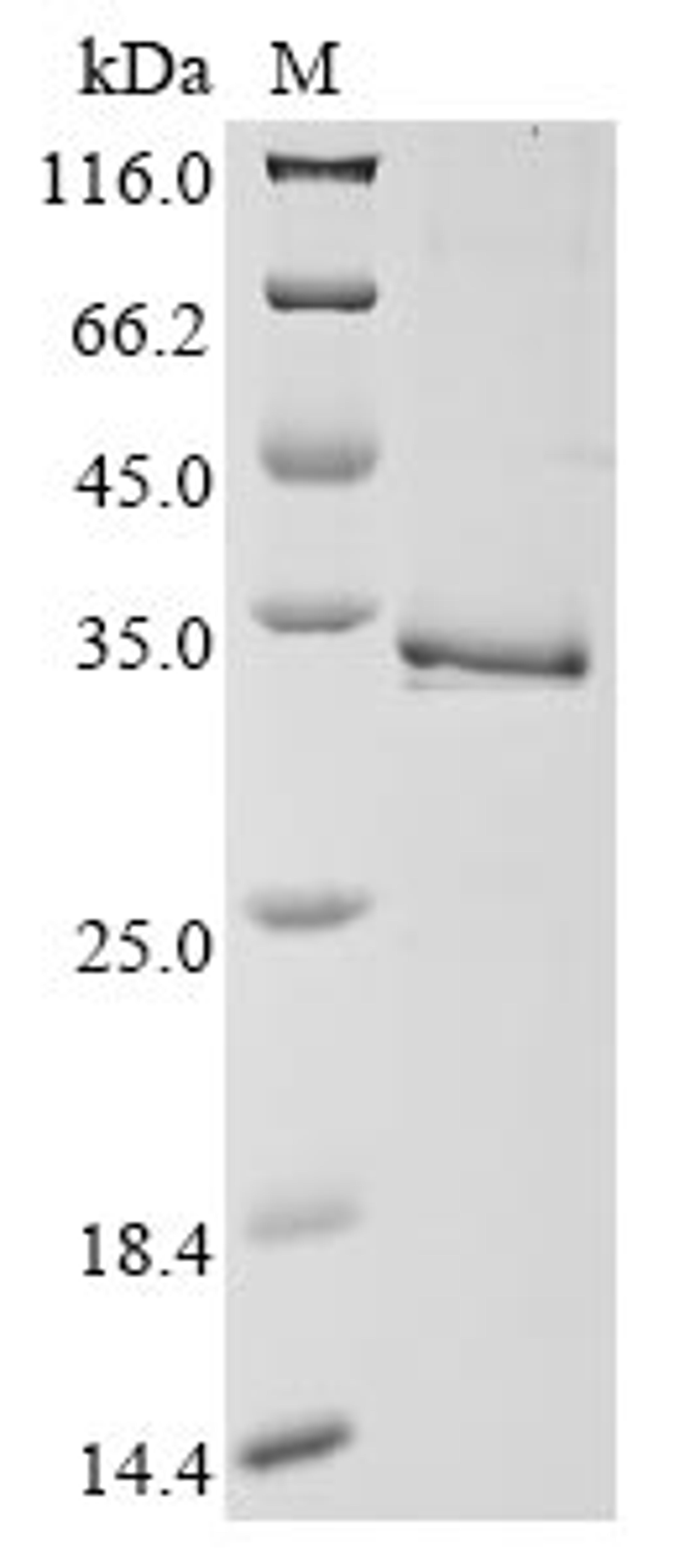 (Tris-Glycine gel) Discontinuous SDS-PAGE (reduced) with 5% enrichment gel and 15% separation gel.