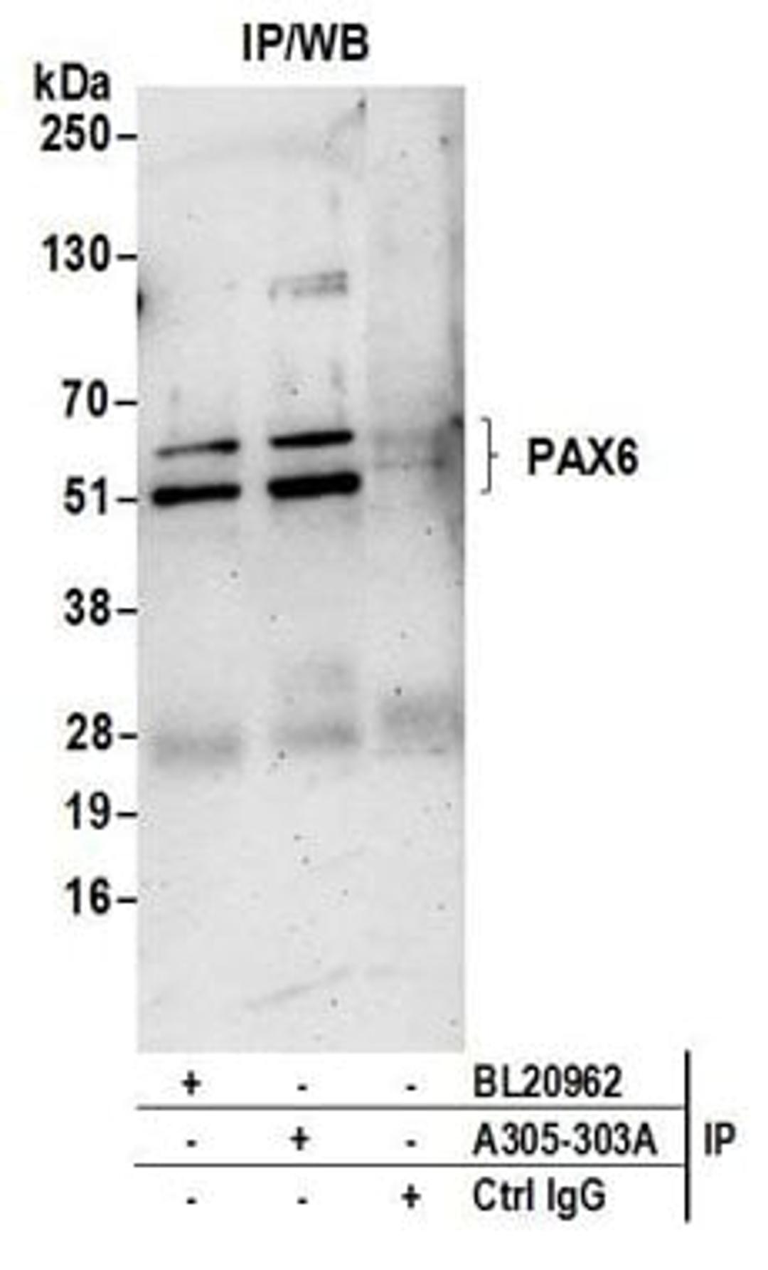 Detection of human PAX6 by western blot of immunoprecipitates.