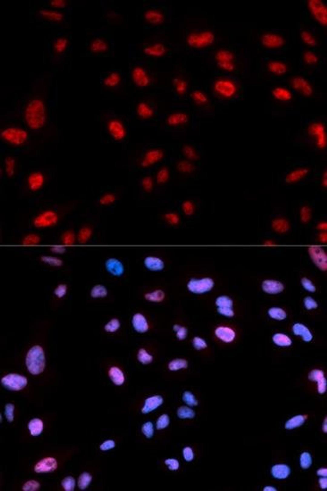 Immunofluorescence analysis of U2OS cell using HIST1H3B antibody