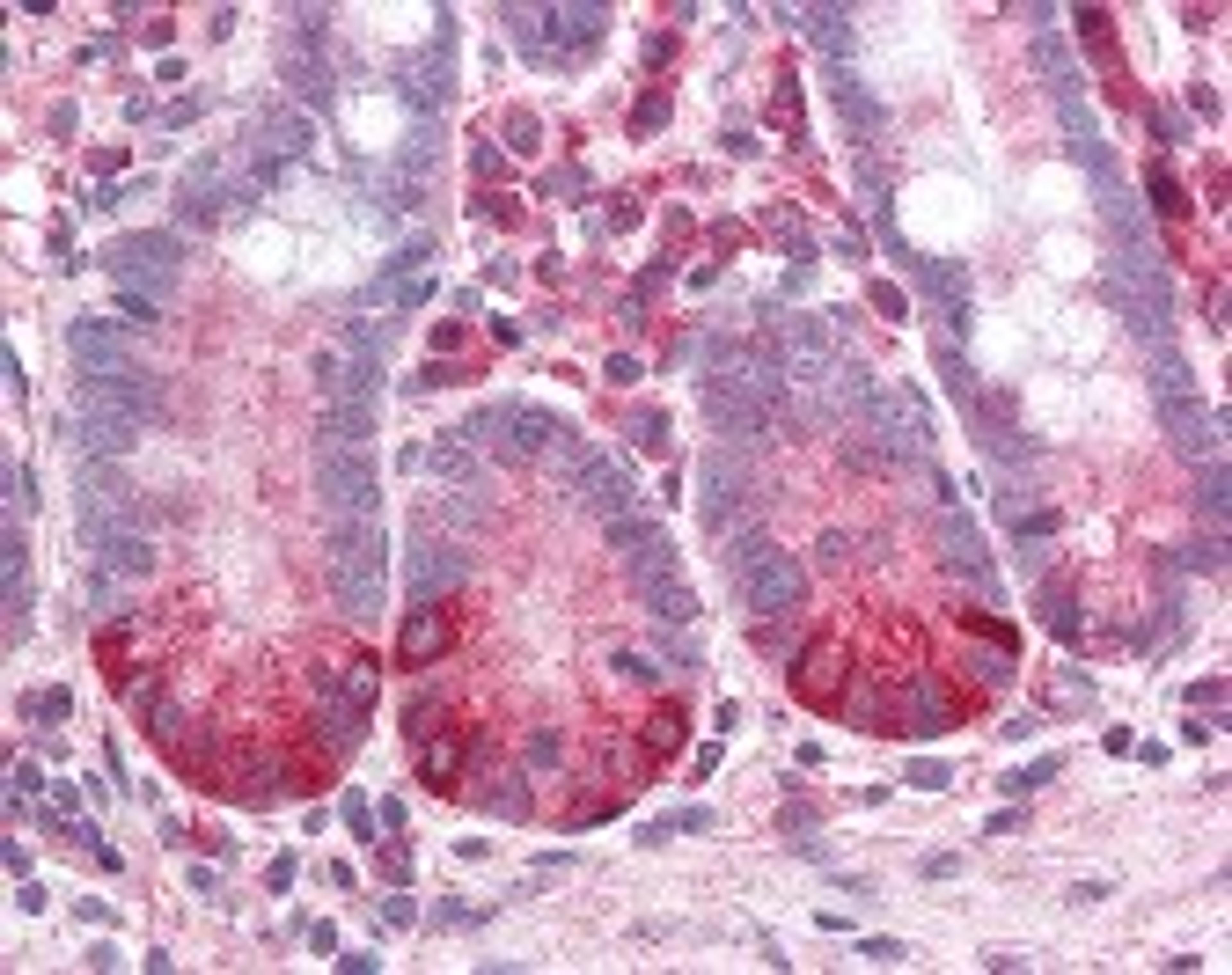 Immunohistochemistry staining of IL-8 Receptor B in small intestine: formalin-fixed, paraffin-embedded (ffpe)IL-8 Receptor B Monoclonal Antibody.