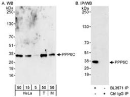 Detection of human and mouse PPP6C by western blot (h&m) and immunoprecipitation (h).