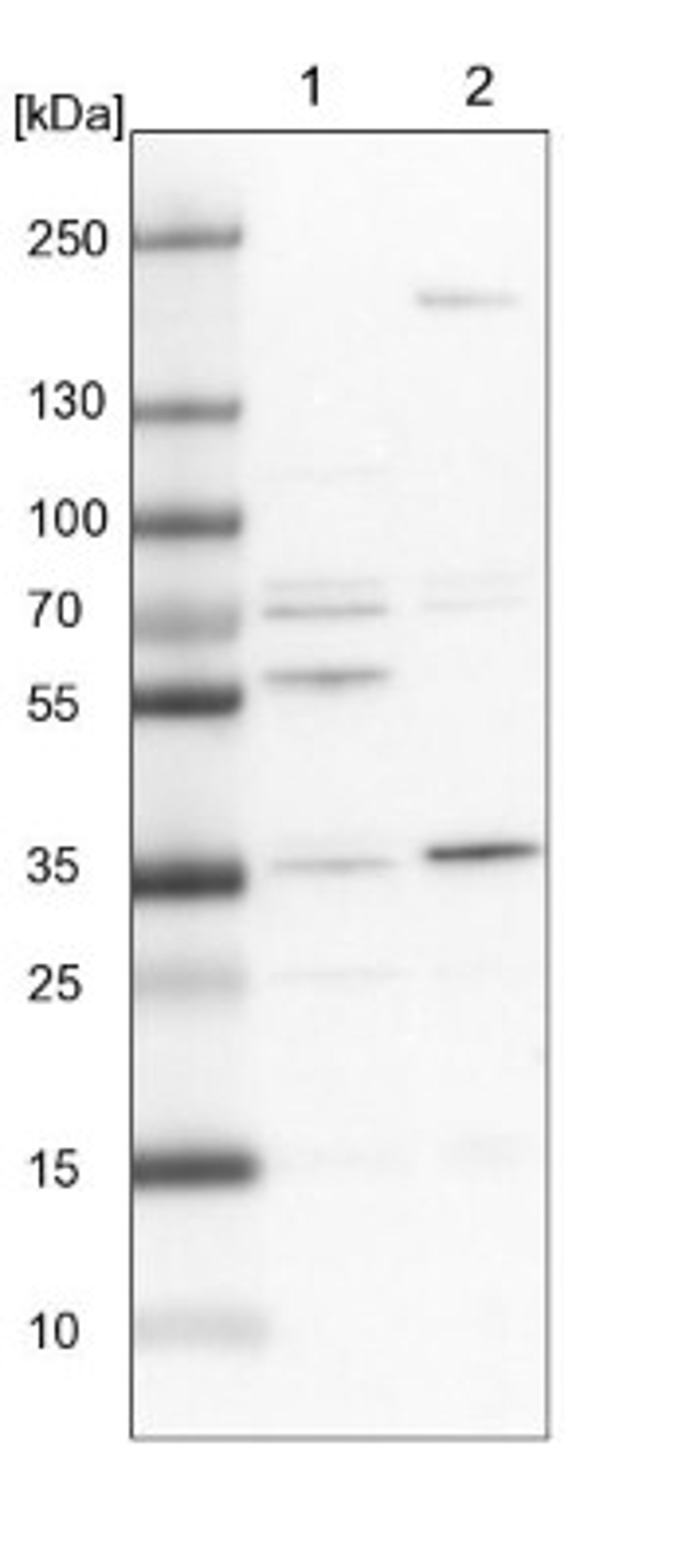 Western Blot: C19orf47 Antibody [NBP1-91722] - Lane 1: NIH-3T3 cell lysate (Mouse embryonic fibroblast cells)<br/>Lane 2: NBT-II cell lysate (Rat Wistar bladder tumour cells)