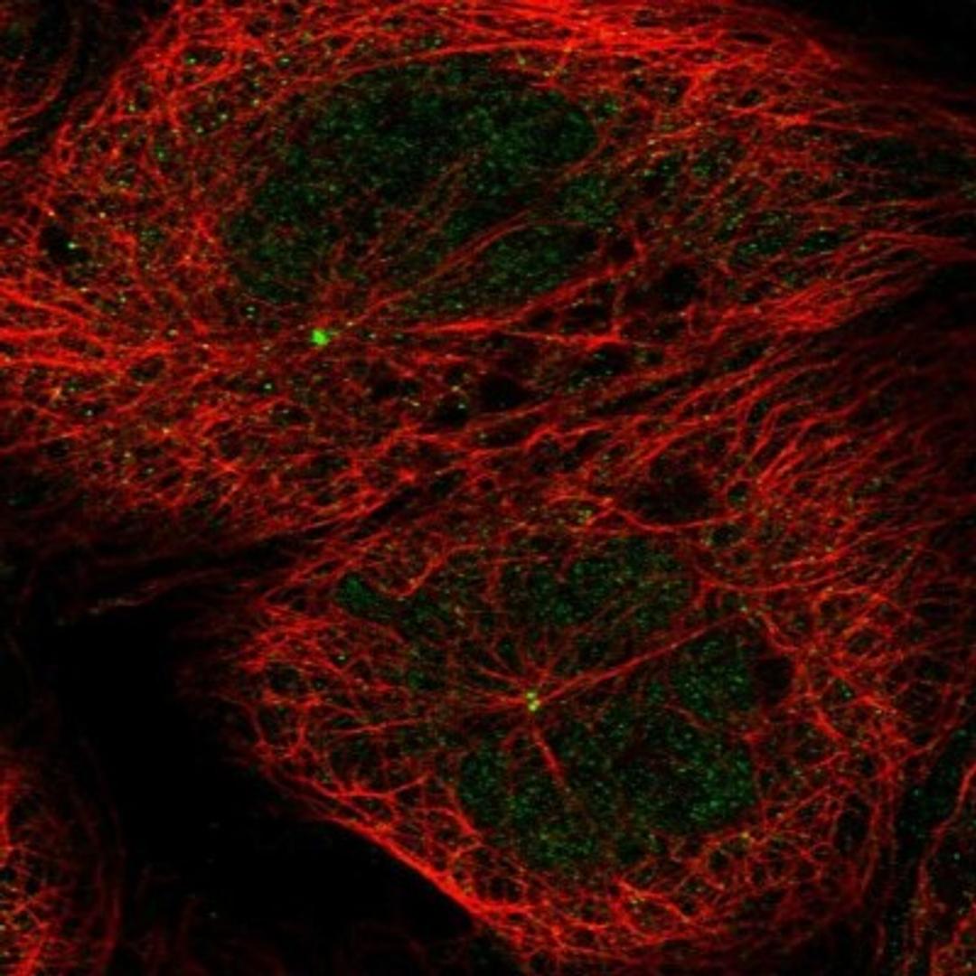 Immunocytochemistry/Immunofluorescence: C10orf107 Antibody [NBP1-88738] - Staining of human cell line A-431 shows positivity in nucleus, cytoplasm & centrosome.