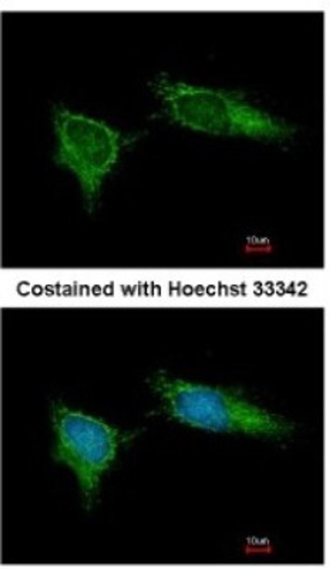 Immunocytochemistry/Immunofluorescence: NDUFB5 Antibody [NBP1-31684] - Analysis of methanol-fixed HeLa, using antibody at 1:200 dilution.