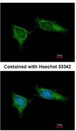 Immunocytochemistry/Immunofluorescence: NDUFB5 Antibody [NBP1-31684] - Analysis of methanol-fixed HeLa, using antibody at 1:200 dilution.