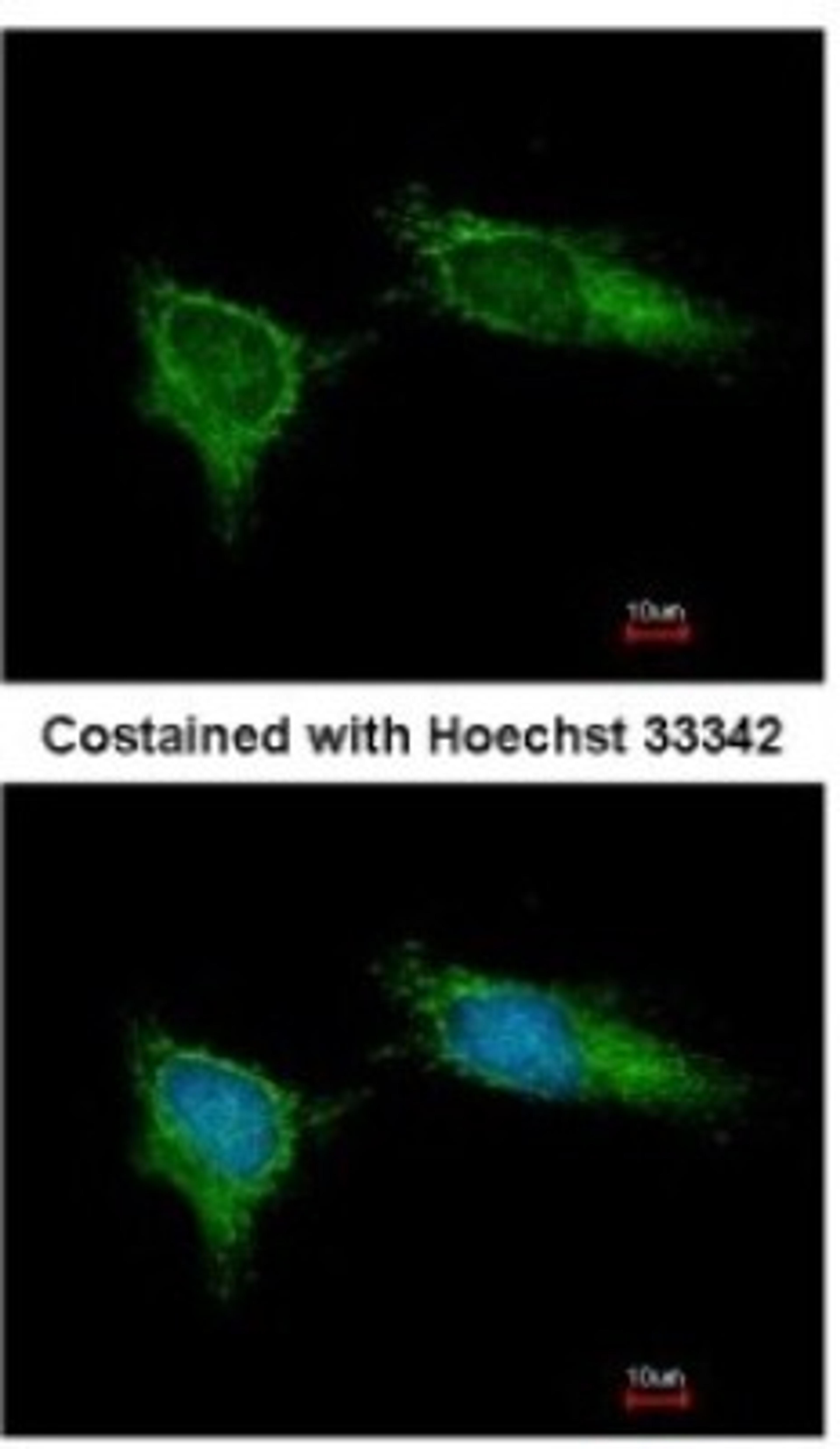 Immunocytochemistry/Immunofluorescence: NDUFB5 Antibody [NBP1-31684] - Analysis of methanol-fixed HeLa, using antibody at 1:200 dilution.