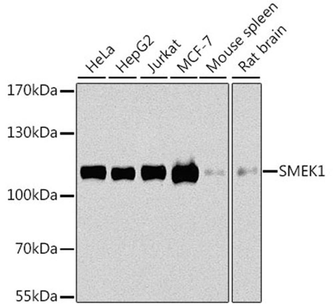 Western blot - SMEK1 antibody (A8500)