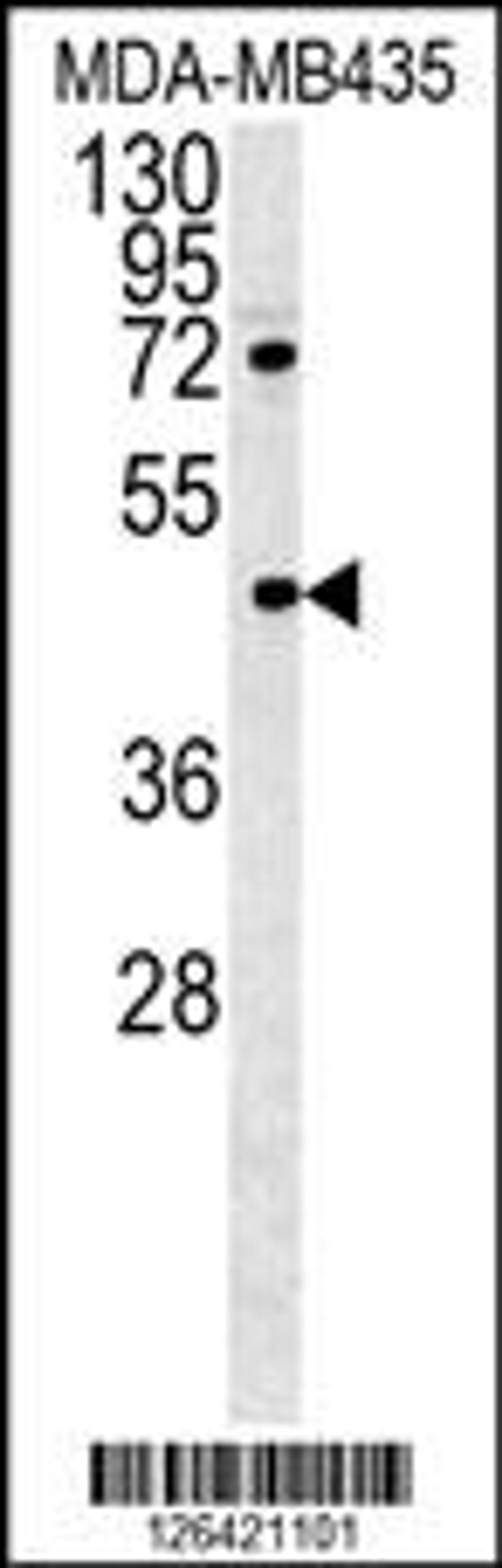 Western blot analysis in MDA-MB435 cell line lysates (35ug/lane).