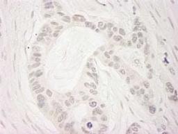 Detection of human BubR1 by immunohistochemistry.