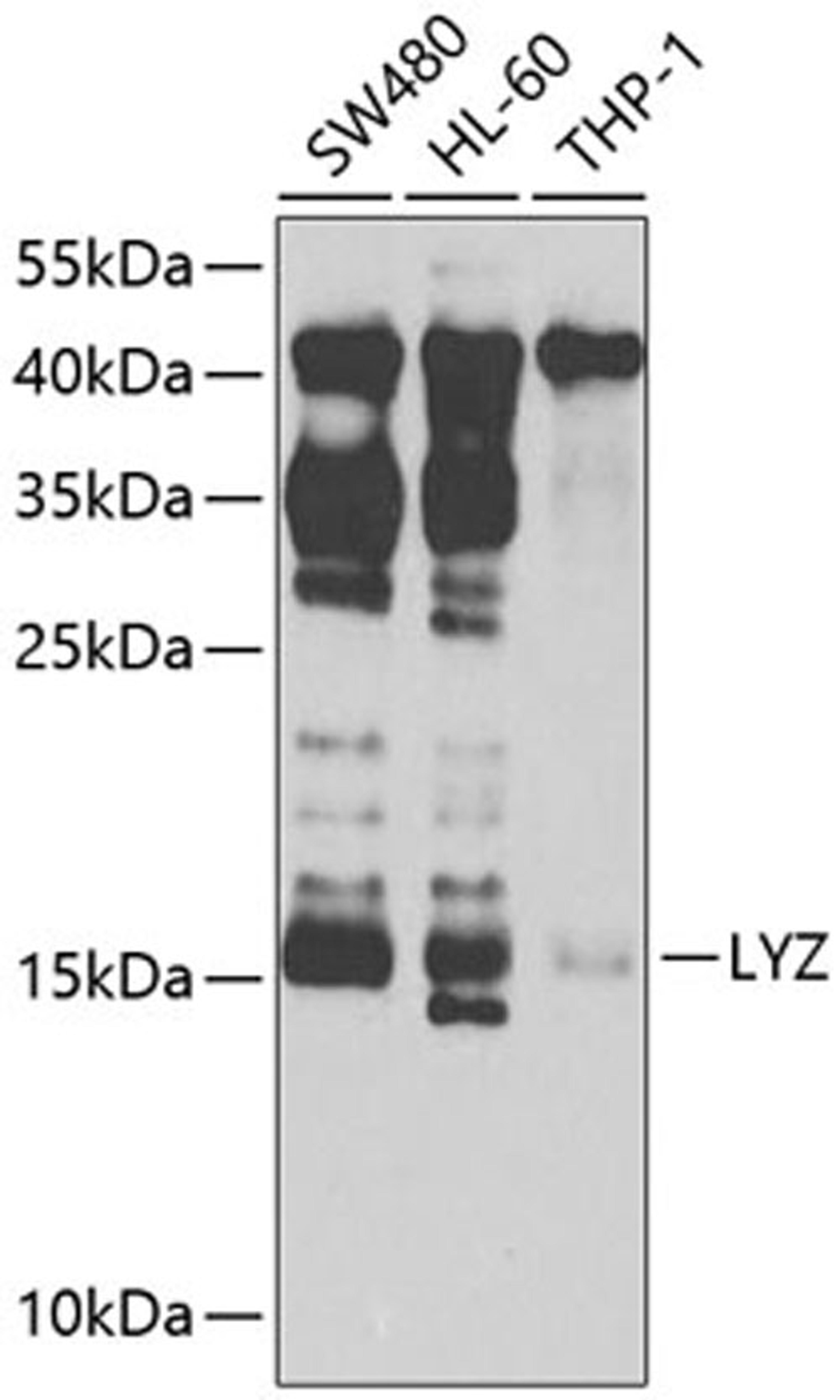 Western blot - LYZ Antibody (A2503)