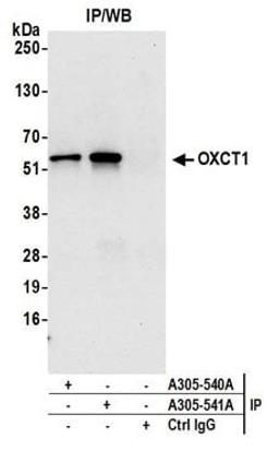 Detection of human OXCT1 by western blot of immunoprecipitates.