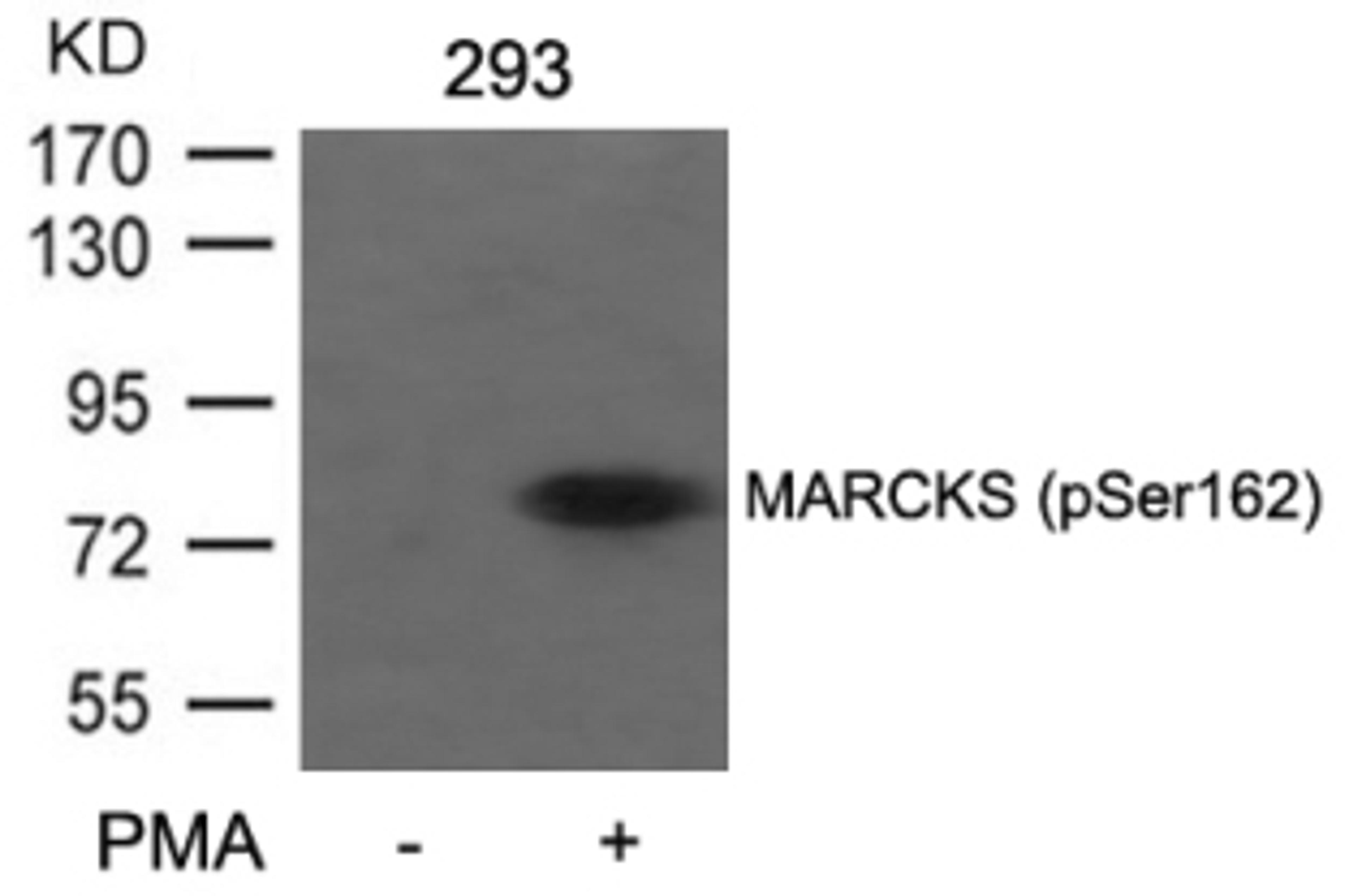 Western blot analysis of lysed extracts from 293 cells untreated or treated with PMA using MARCKS (Phospho-Ser162).