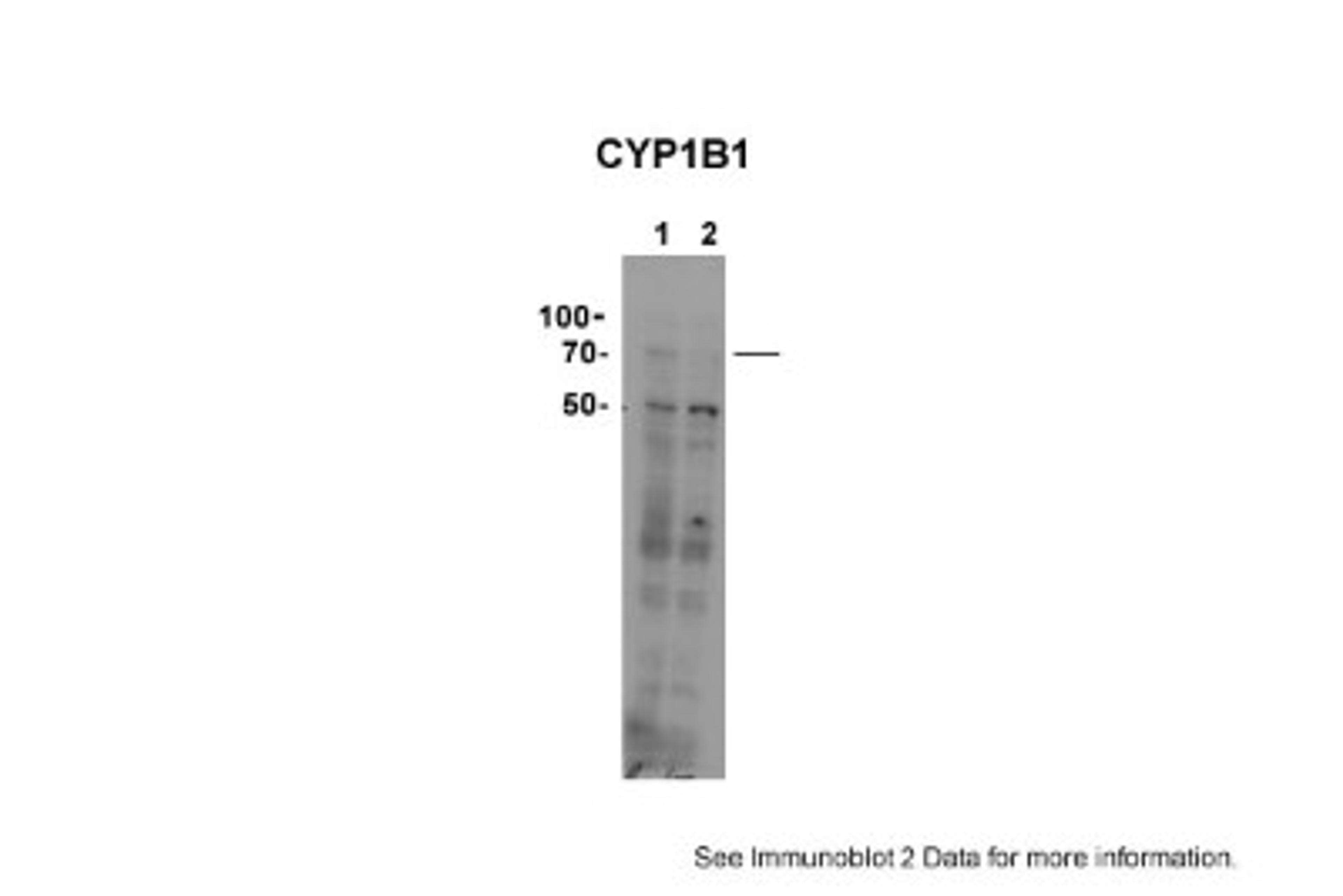 Western Blot: CYP11B1 Antibody [NBP1-68883] - 1. HEK293TN-GFP-hcyp11B1 (75ug) 2. HEK293TN-GFP-hcyp11B2 (75ug) Primary dilution: 1 : 100 Secondary Antibody: mouse anti-Rabbit HRP Secondary Dilution: 1 : 10,000Film Exposed for: 5 minutesImage Submitted by: Celso Gomez-SanchezMongomery VA Medical Center.