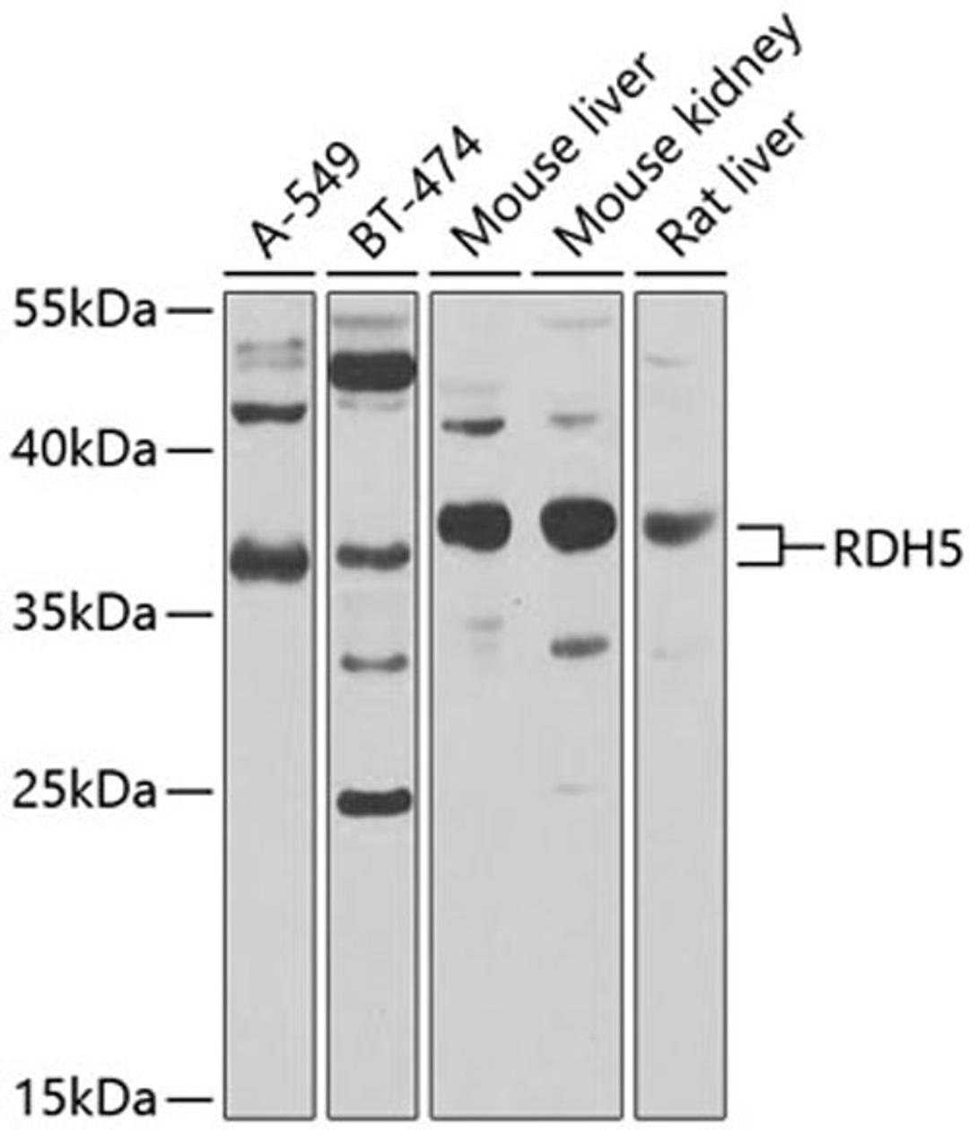 Western blot - RDH5 antibody (A8055)